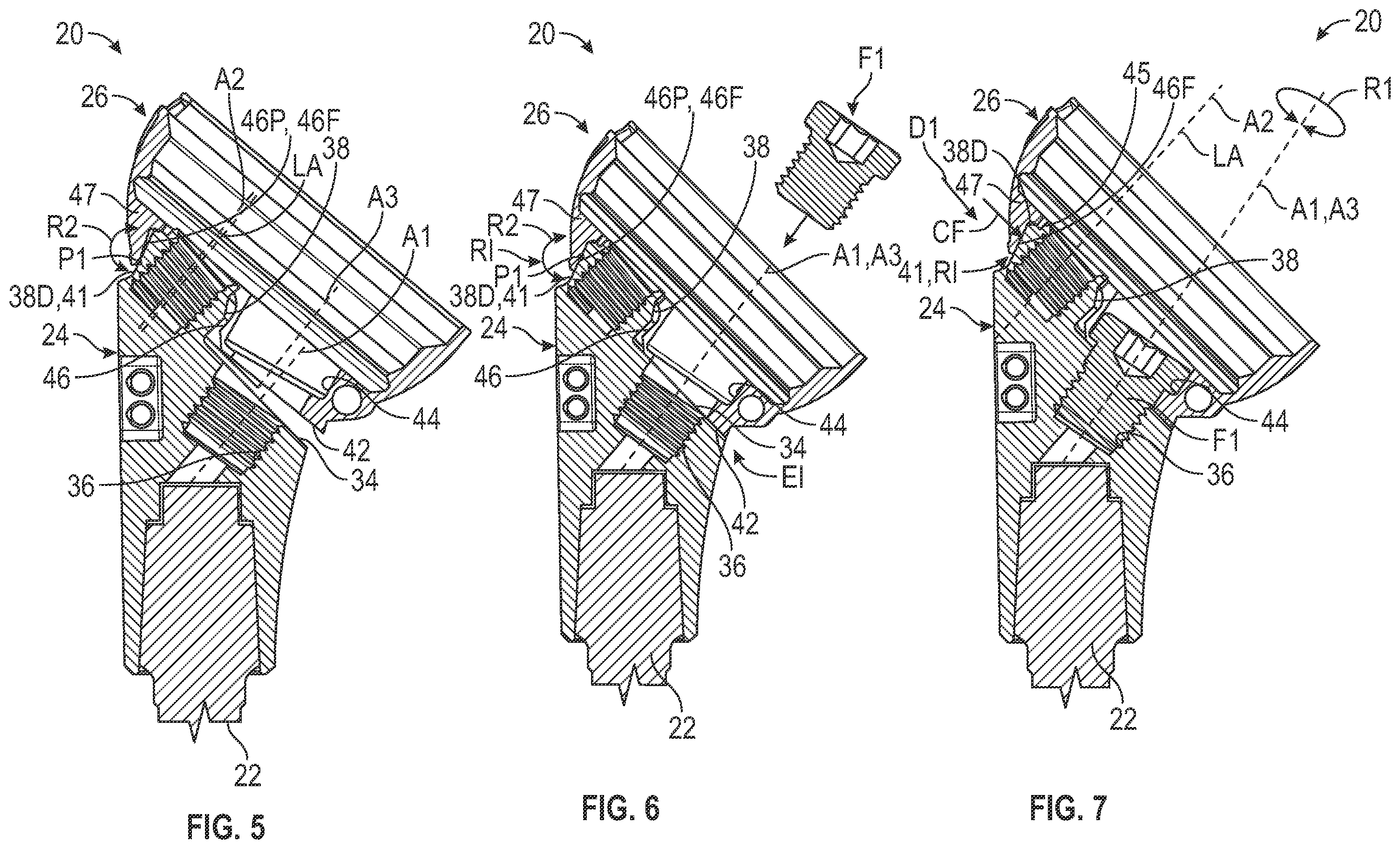 Patent US12496192 Figure 4 – Hydraulic taper separator for orthopaedic implant systems and methods of disassembly