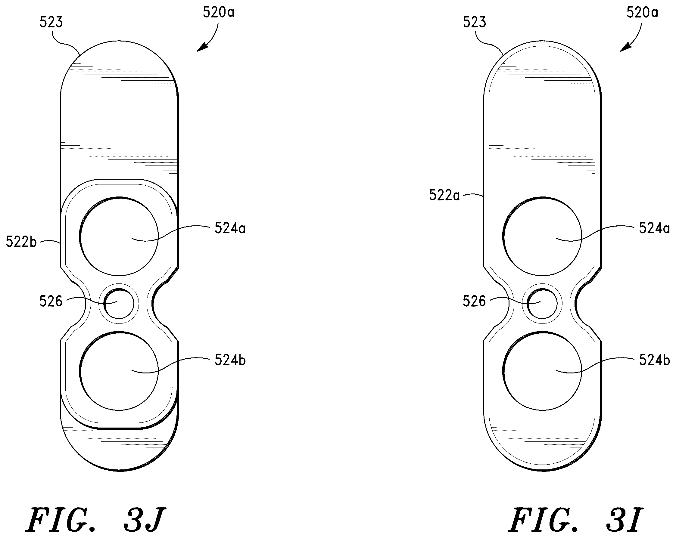 Patent US12496193 Figure 12 – Methods for sacroiliac joint stabilization