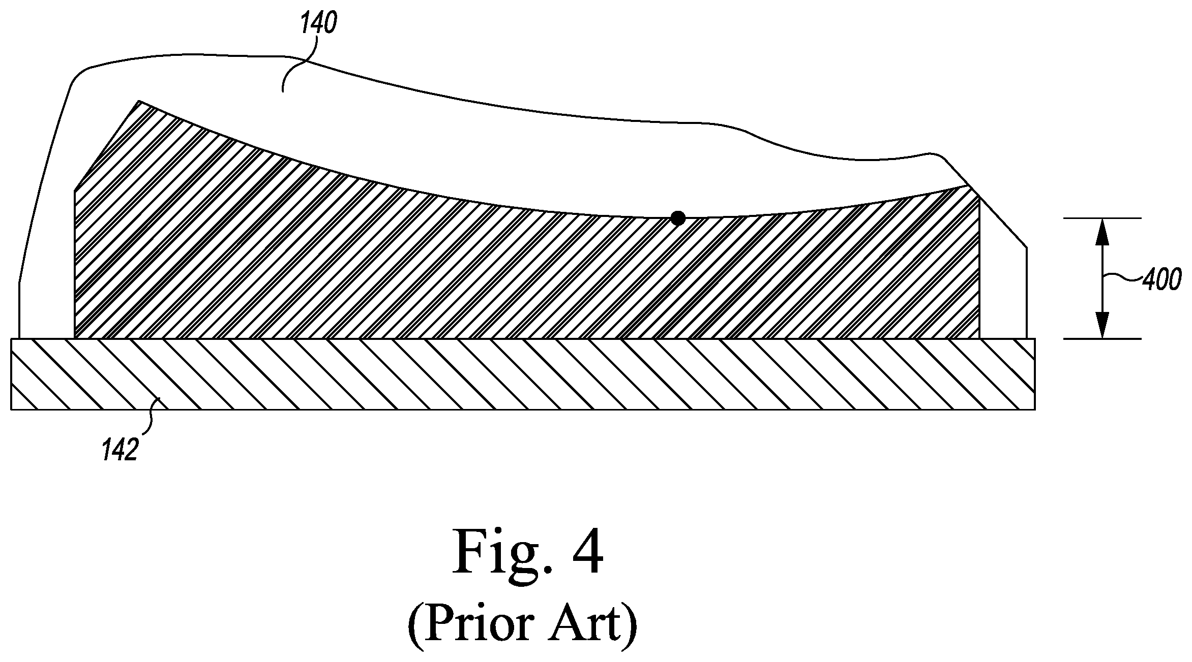 Patent US12496194 Figure 3 – Orthopaedic implant system with bone conserving features