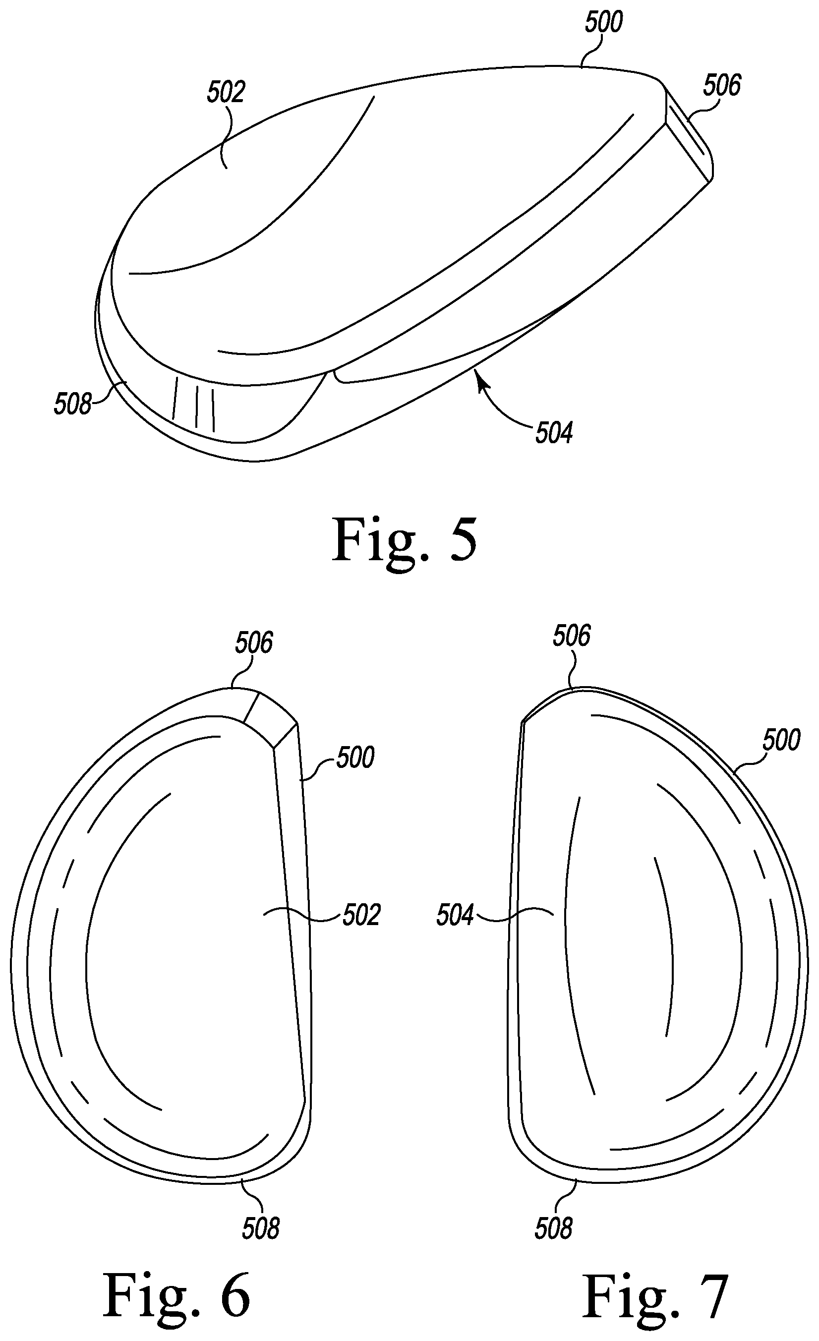 Patent US12496194 Figure 4 – Orthopaedic implant system with bone conserving features