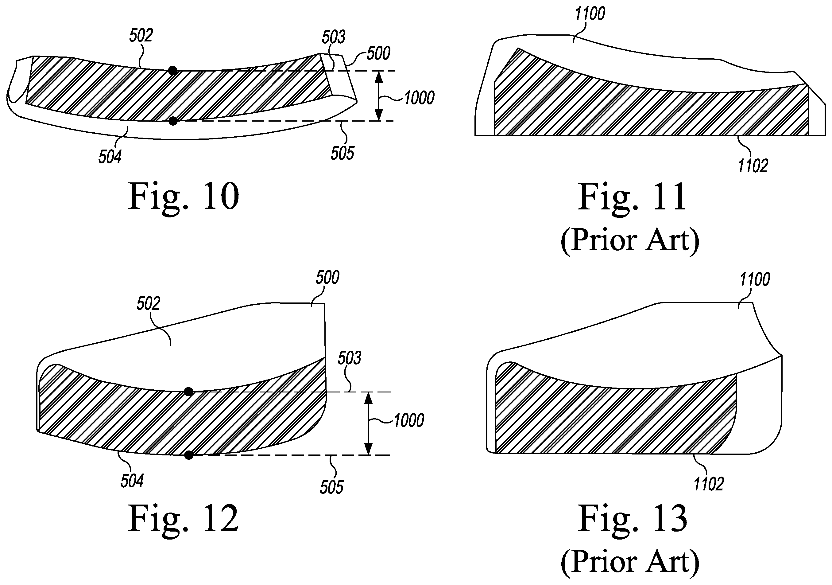 Patent US12496194 Figure 6 – Orthopaedic implant system with bone conserving features