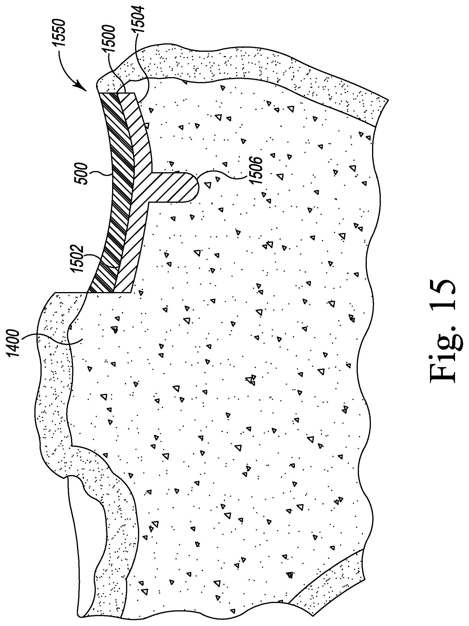 Patent US12496194 Figure 8 – Orthopaedic implant system with bone conserving features