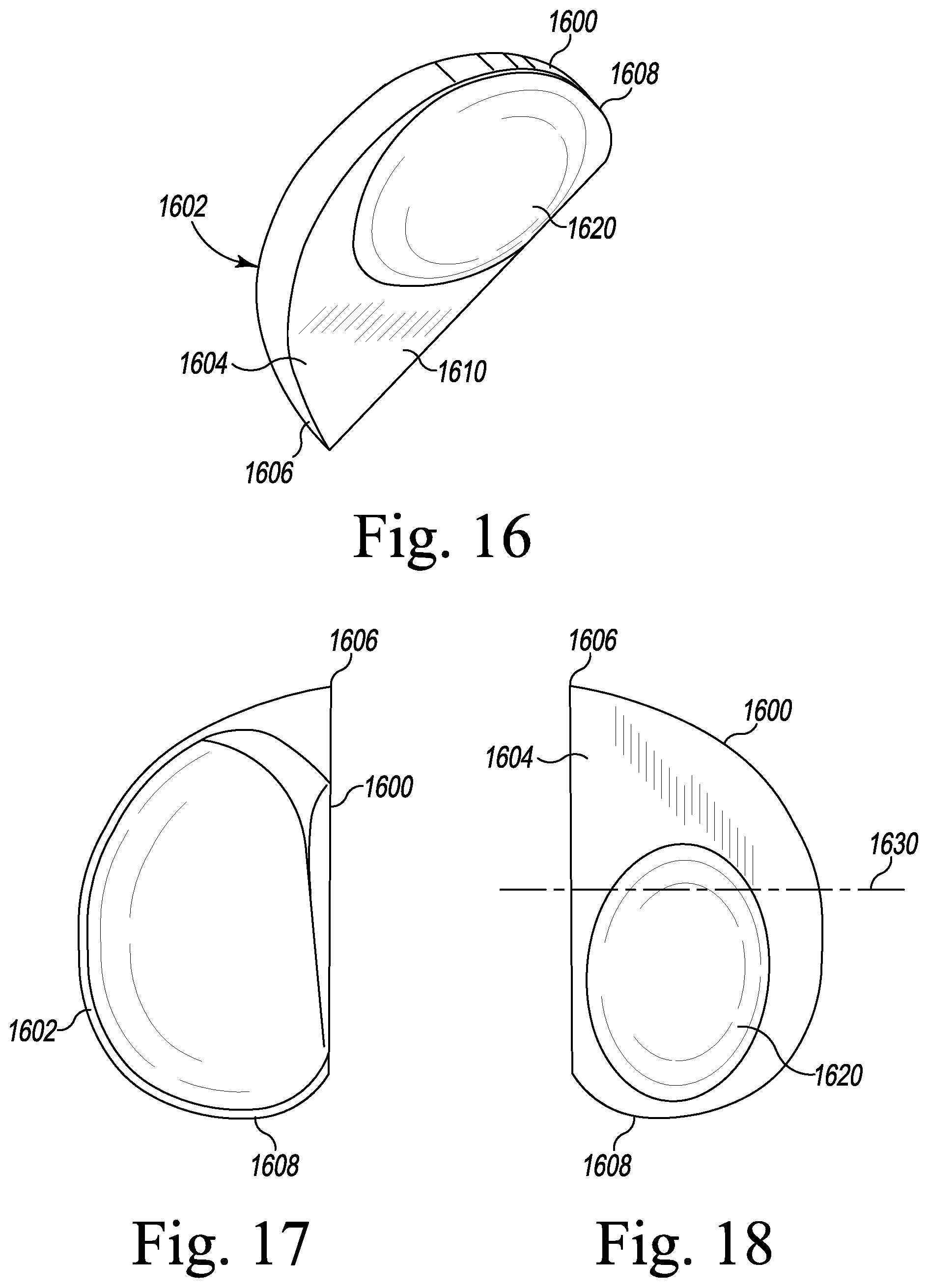 Patent US12496194 Figure 9 – Orthopaedic implant system with bone conserving features