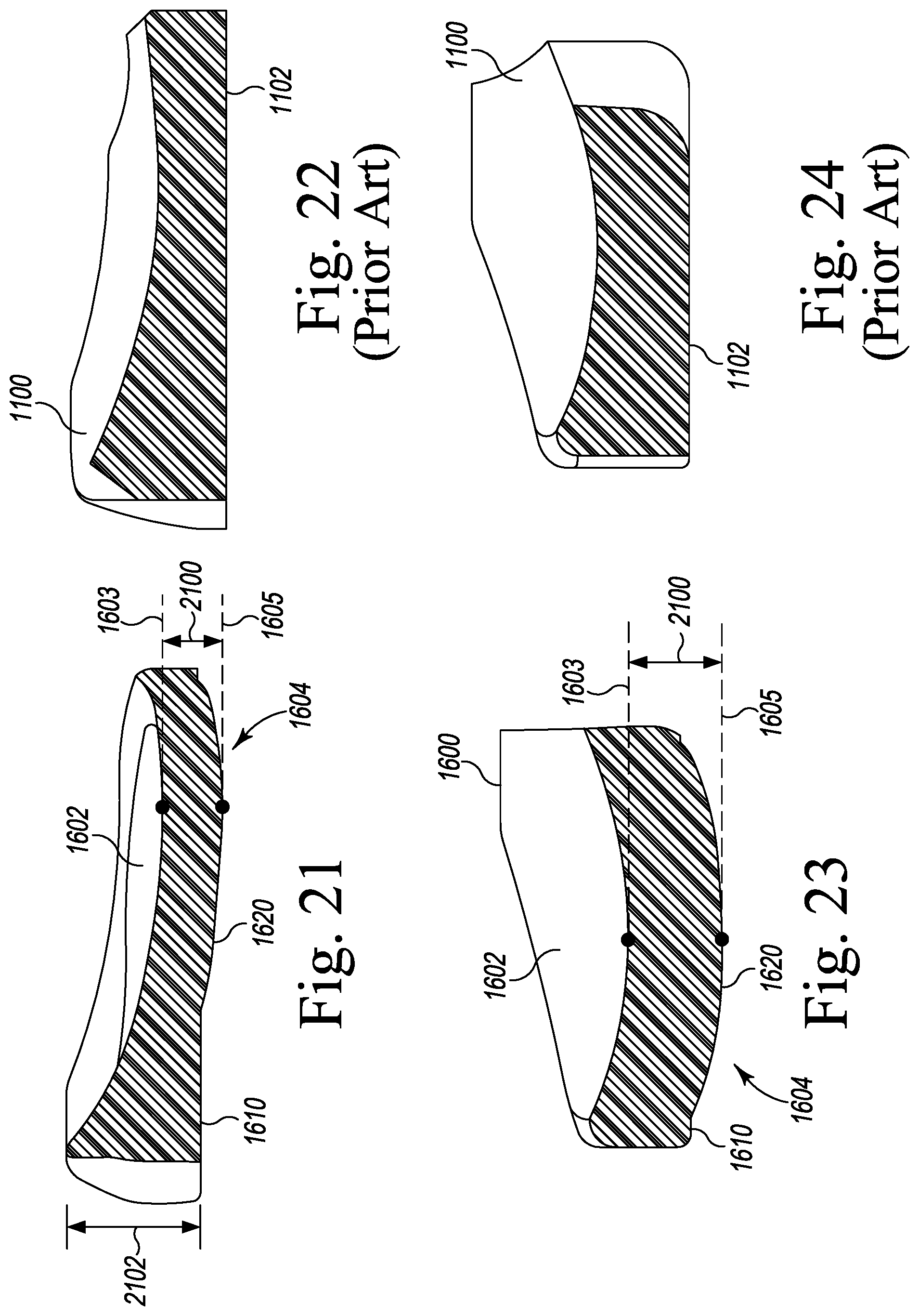 Patent US12496194 Figure 11 – Orthopaedic implant system with bone conserving features
