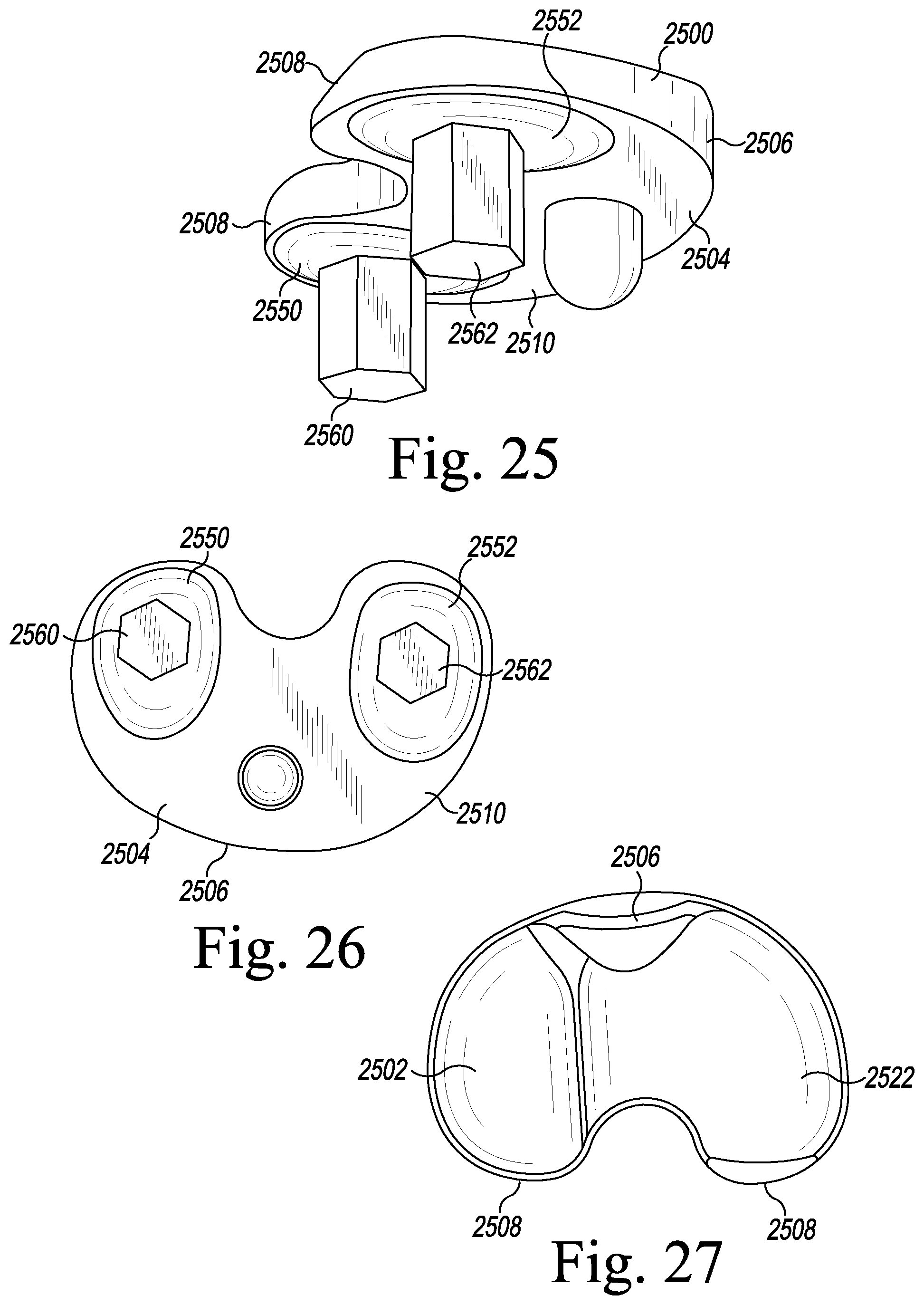 Patent US12496194 Figure 12 – Orthopaedic implant system with bone conserving features