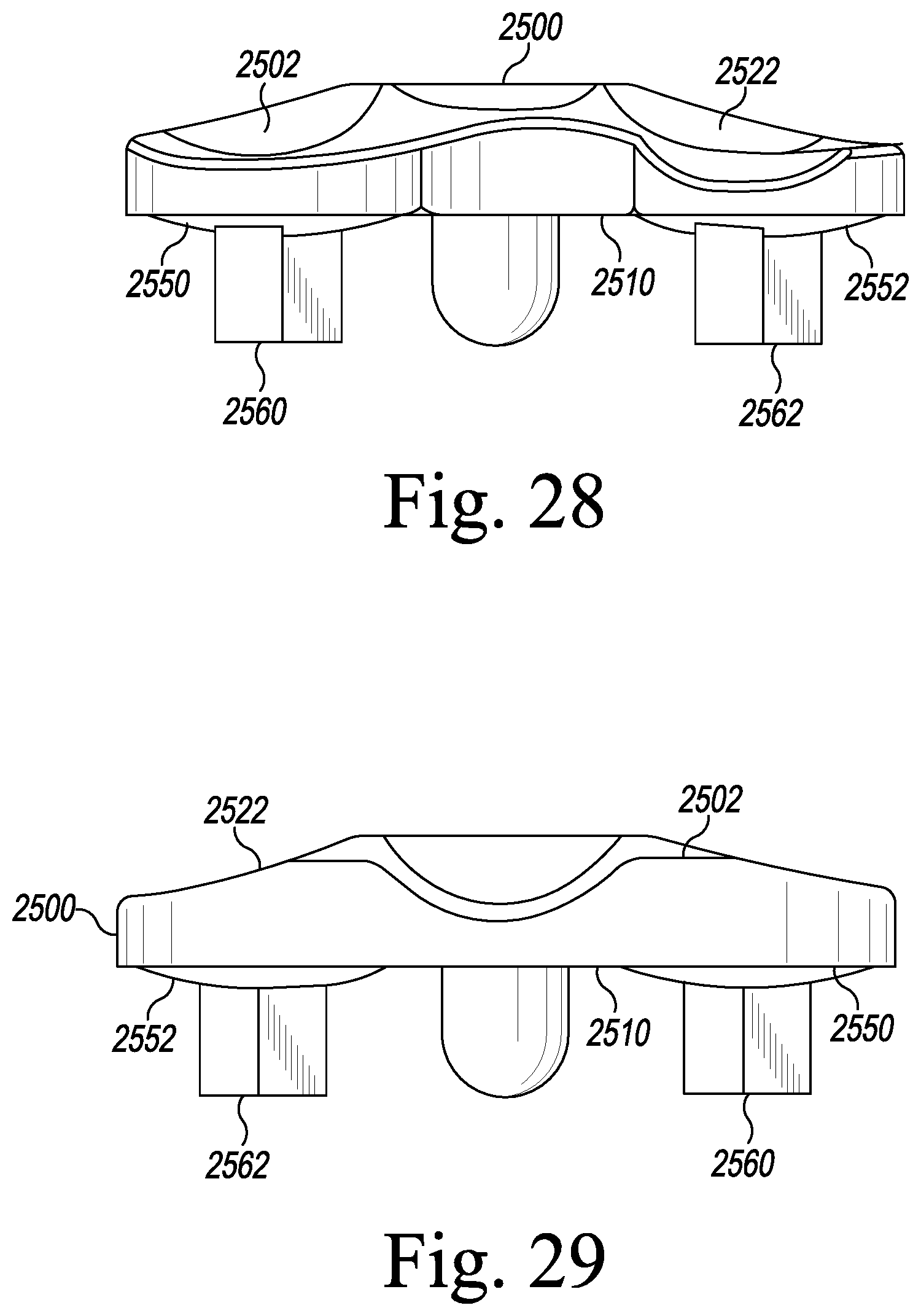 Patent US12496194 Figure 13 – Orthopaedic implant system with bone conserving features