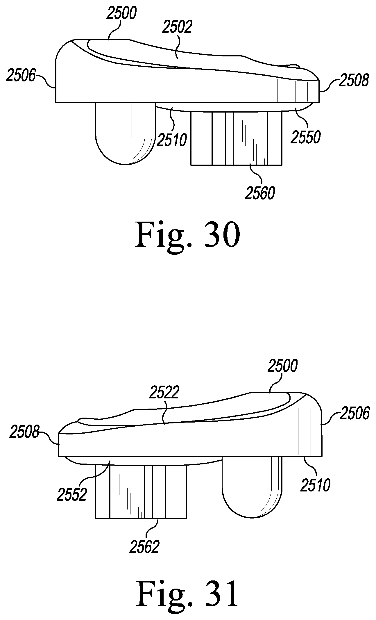 Patent US12496194 Figure 14 – Orthopaedic implant system with bone conserving features