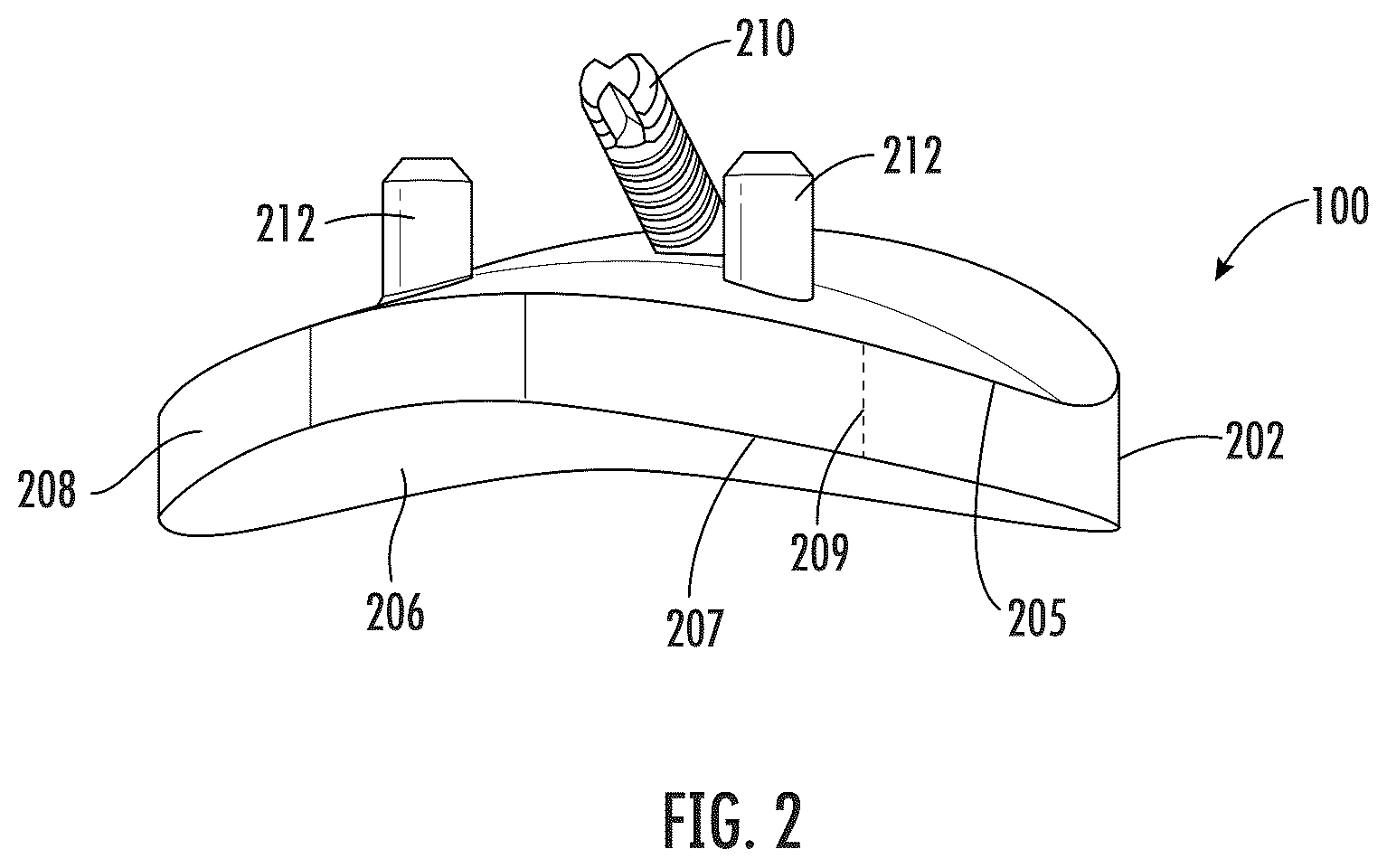 Patent US12496195 Figure 2 – Systems and methods of a glenoid component