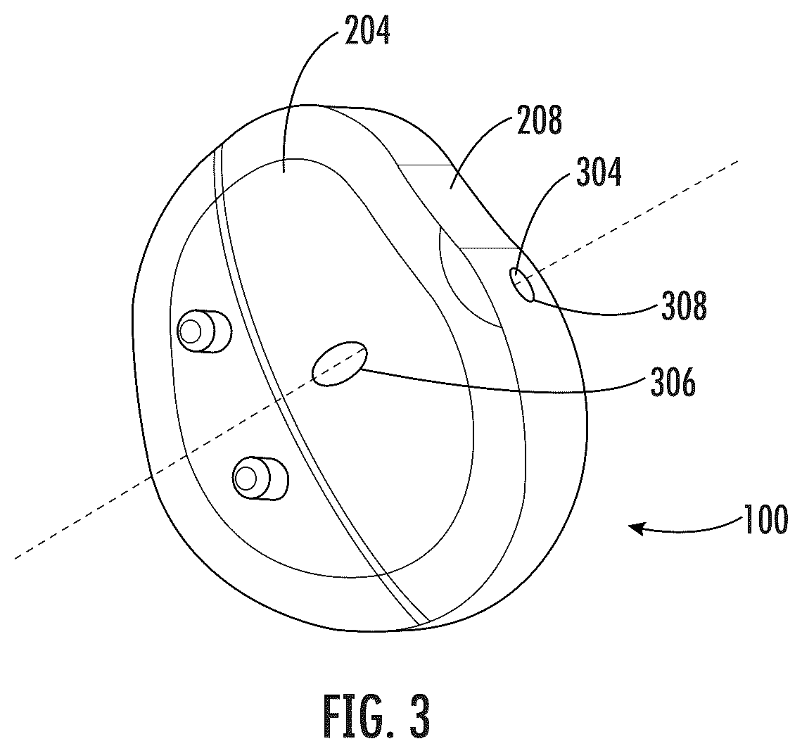 Patent US12496195 Figure 3 – Systems and methods of a glenoid component