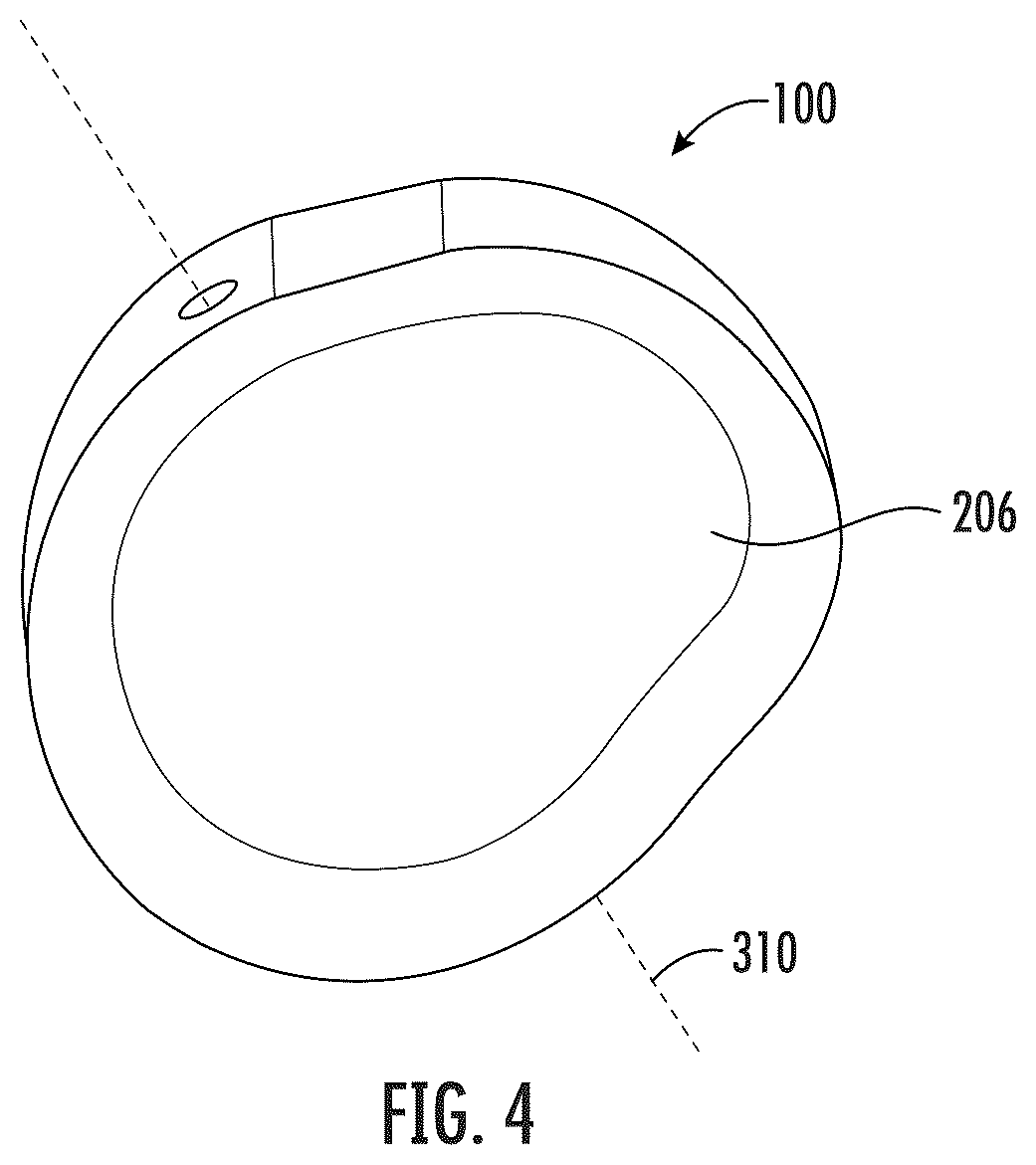 Patent US12496195 Figure 4 – Systems and methods of a glenoid component
