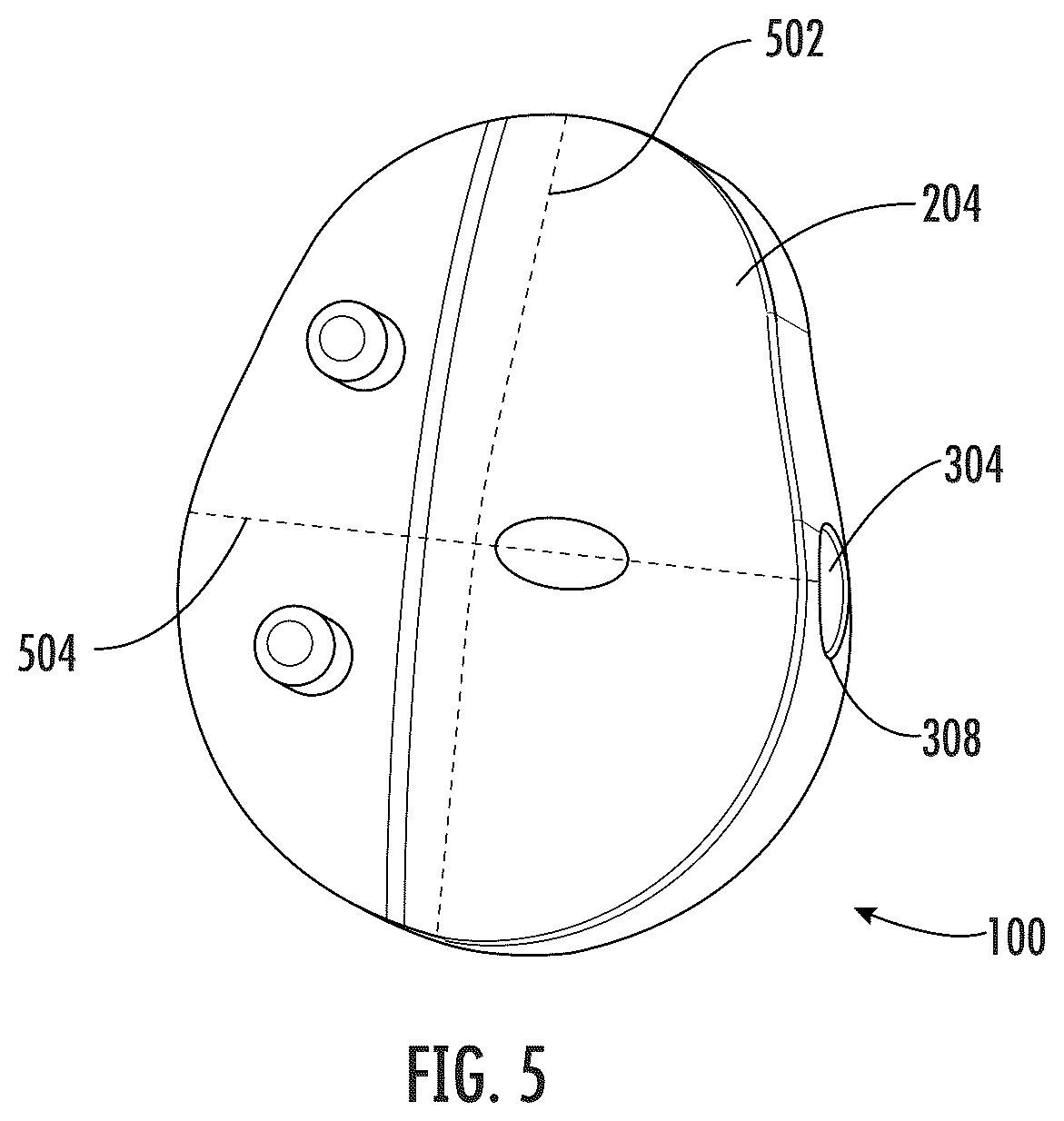 Patent US12496195 Figure 5 – Systems and methods of a glenoid component