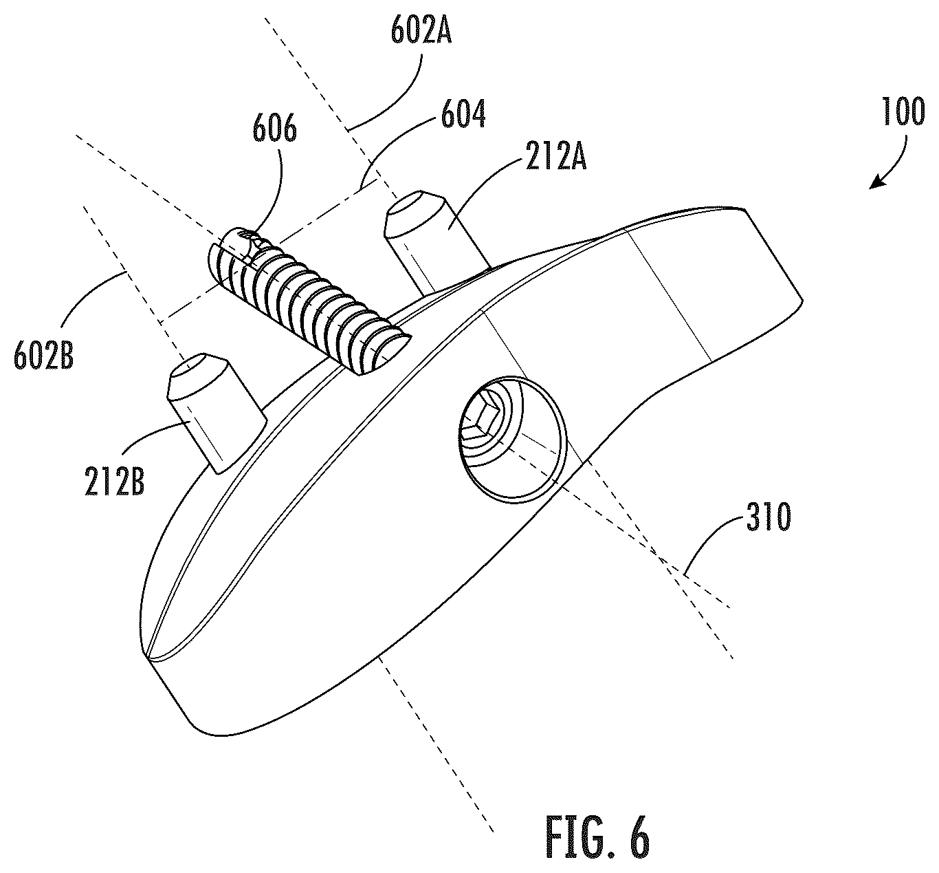 Patent US12496195 Figure 6 – Systems and methods of a glenoid component