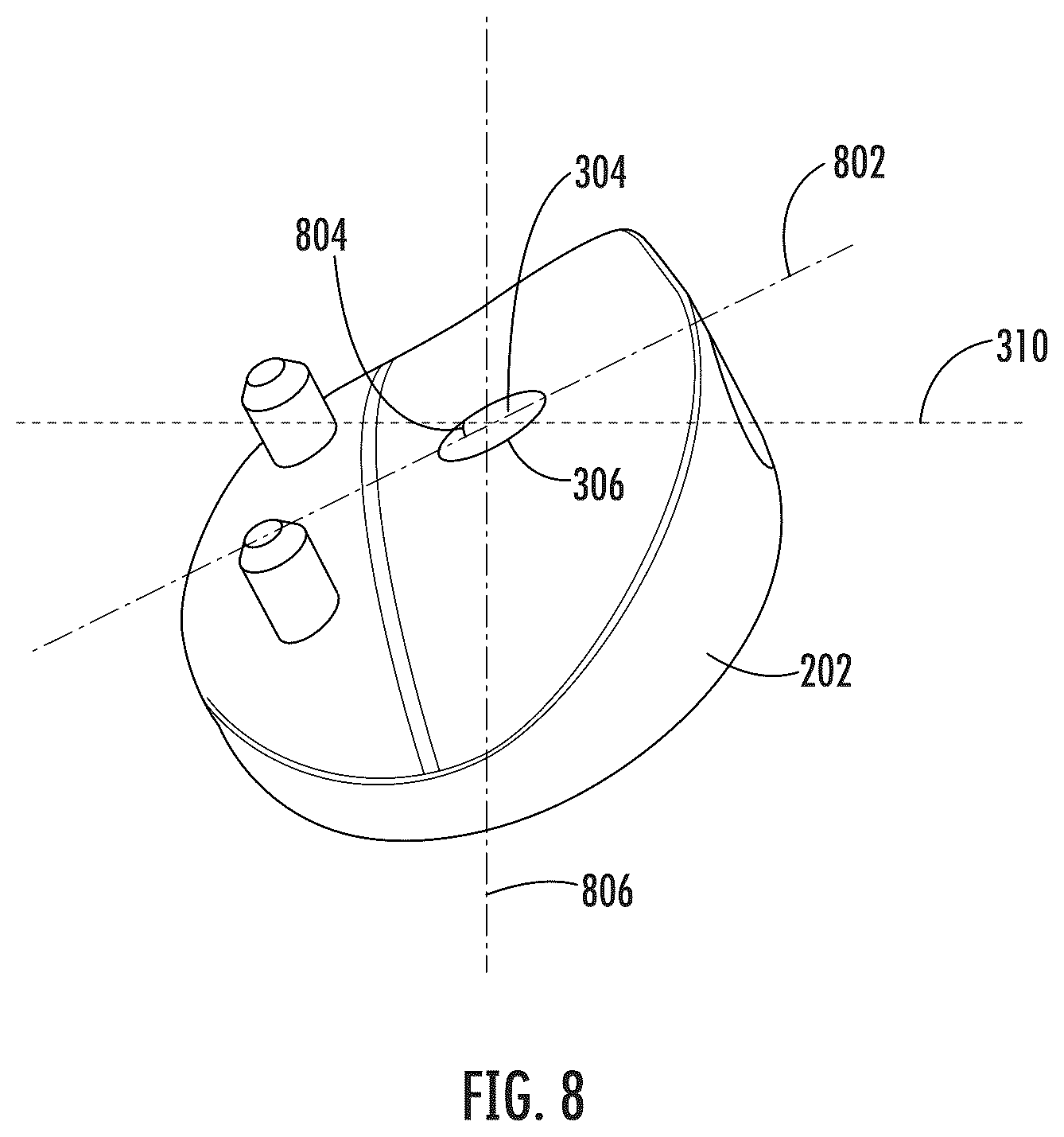 Patent US12496195 Figure 8 – Systems and methods of a glenoid component