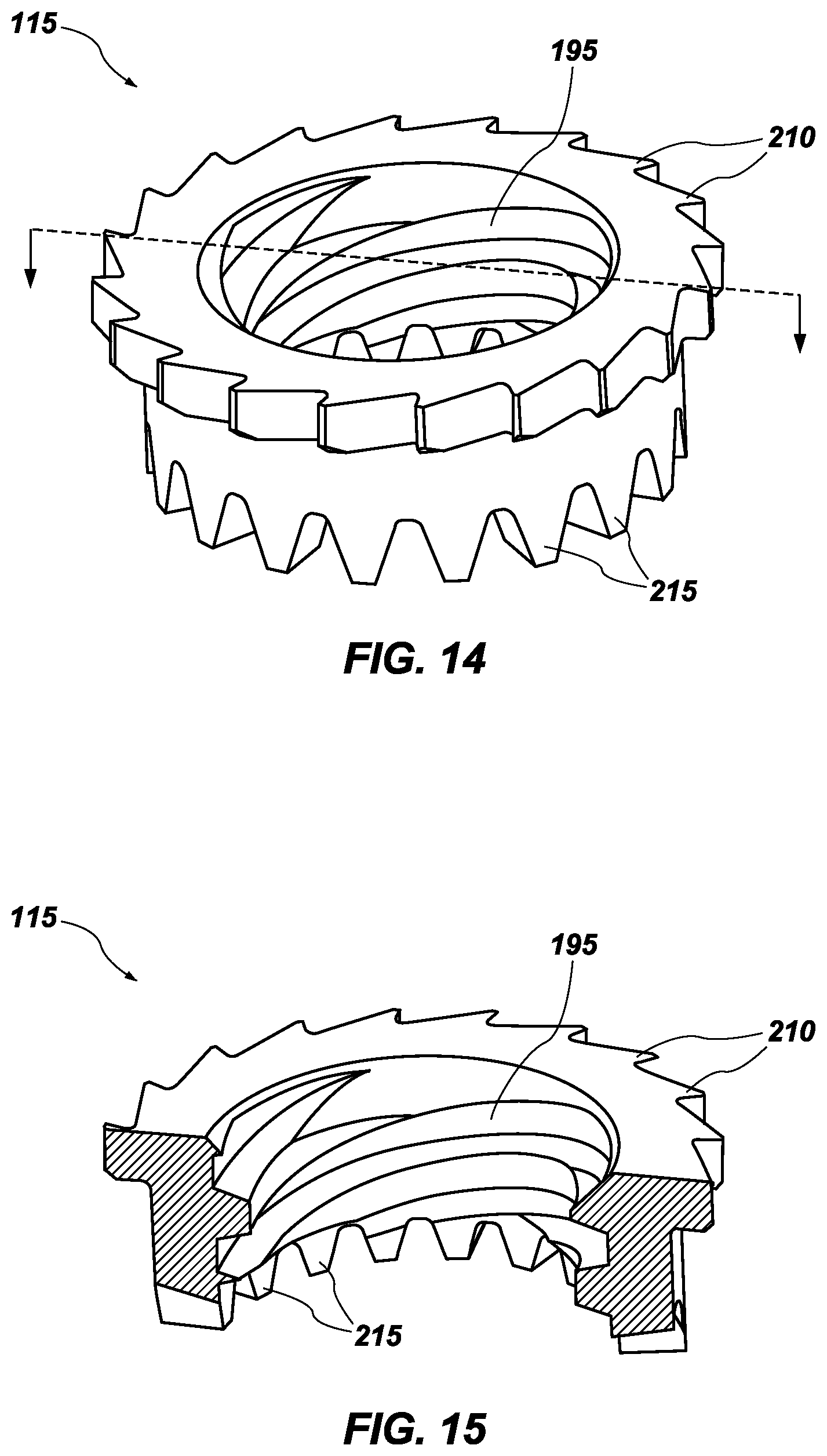 Patent US12496196 Figure 8 – Vertebral body replacement and insertion device
