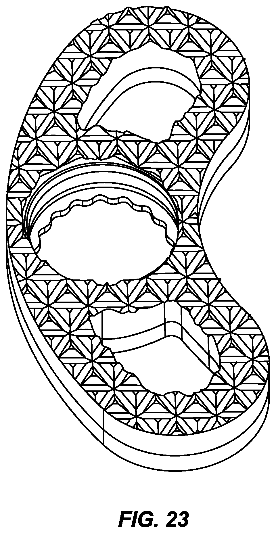 Patent US12496196 Figure 12 – Vertebral body replacement and insertion device