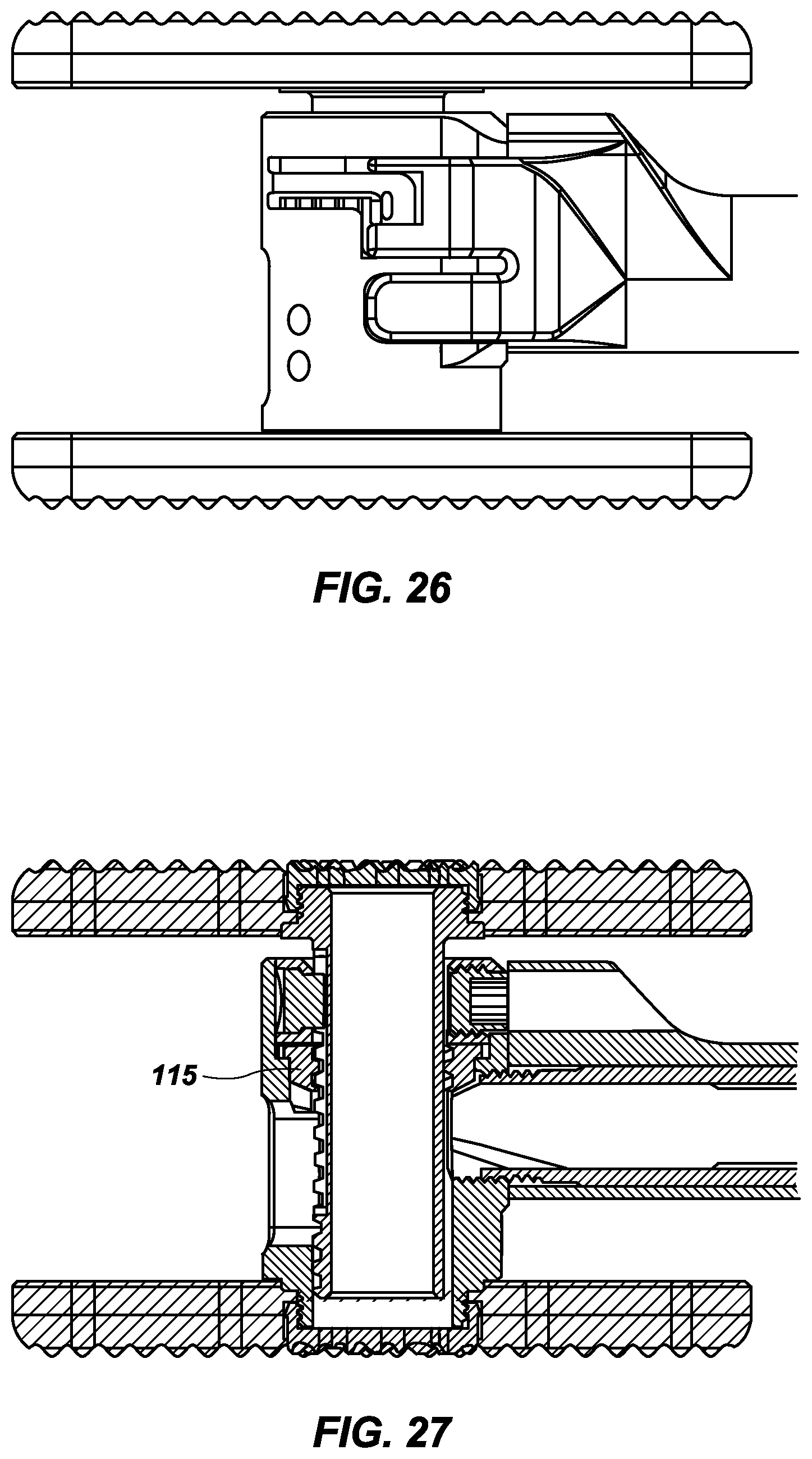 Patent US12496196 Figure 15 – Vertebral body replacement and insertion device