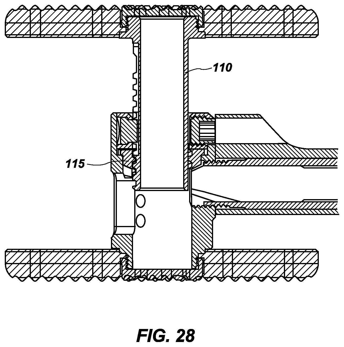 Patent US12496196 Figure 16 – Vertebral body replacement and insertion device