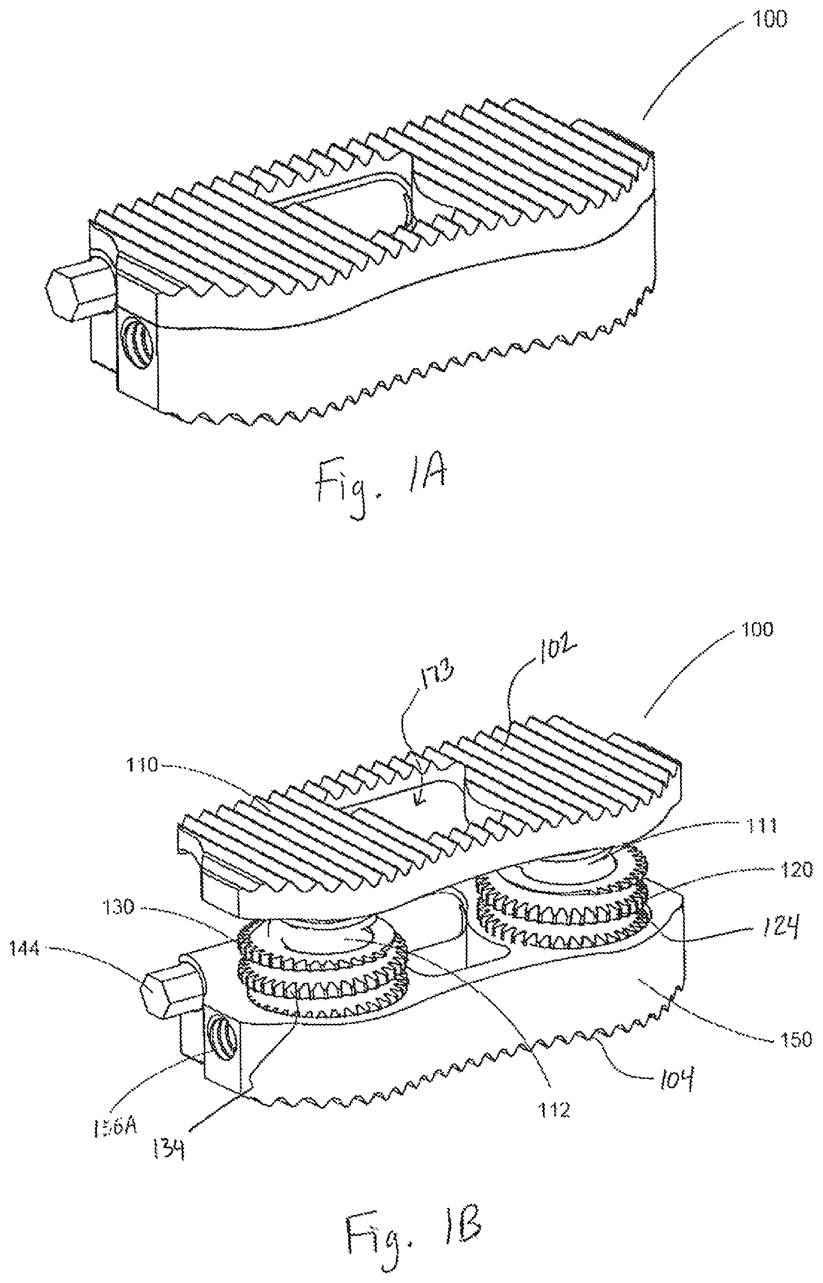 Patent US12496197 Figure 1 – Medical device employing a coaxial screw gear sleeve mechanism