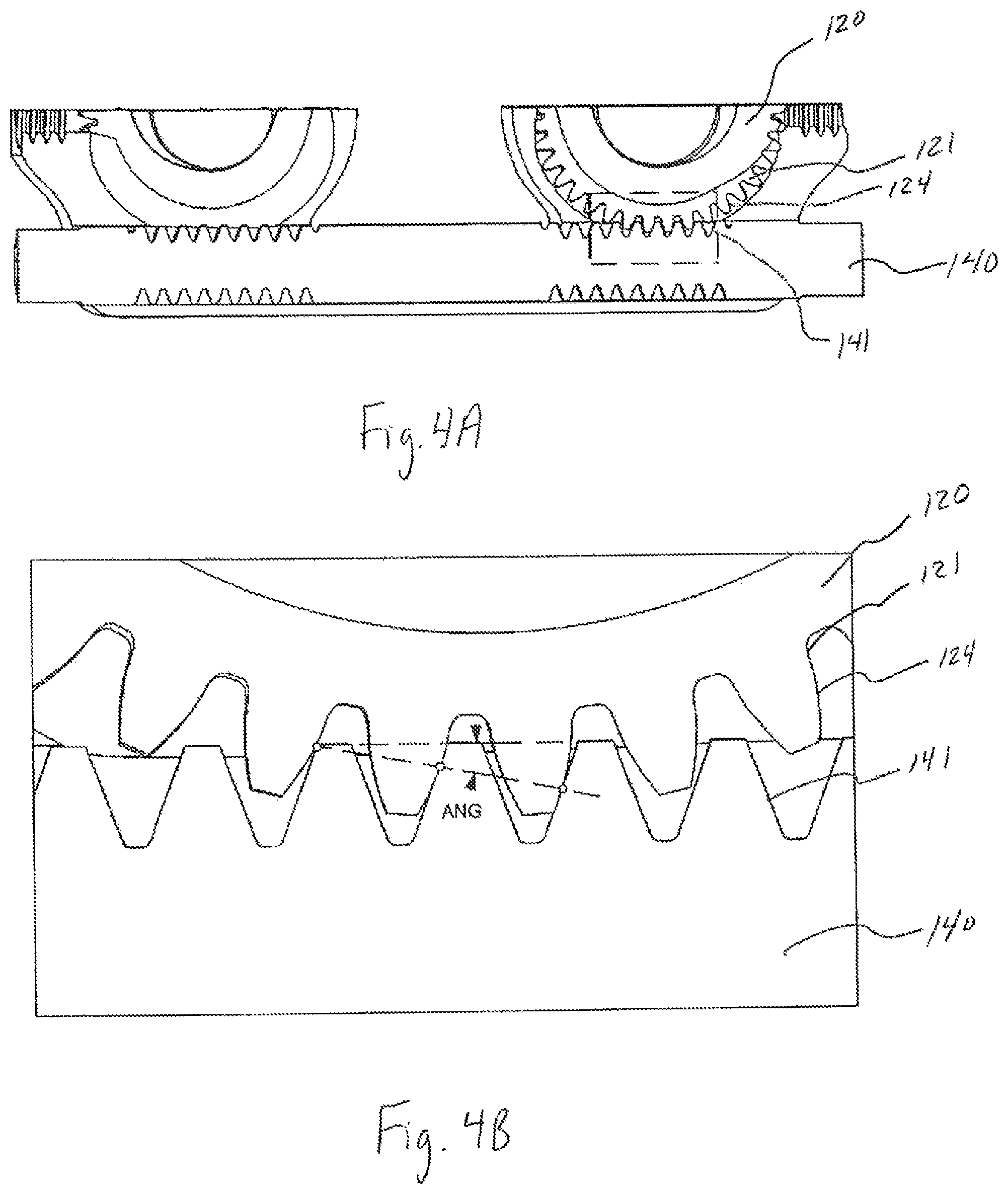 Patent US12496197 Figure 5 – Medical device employing a coaxial screw gear sleeve mechanism