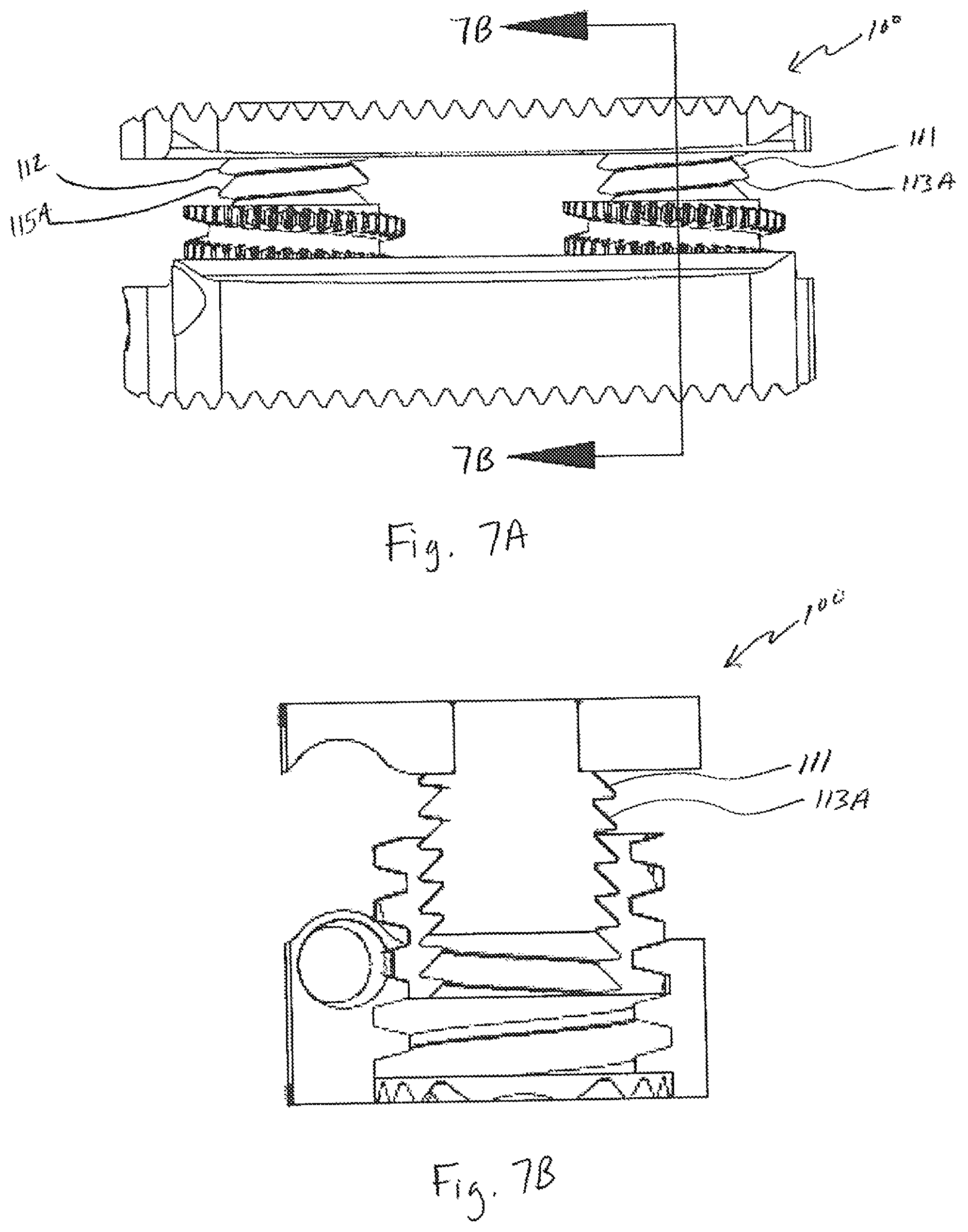 Patent US12496197 Figure 9 – Medical device employing a coaxial screw gear sleeve mechanism