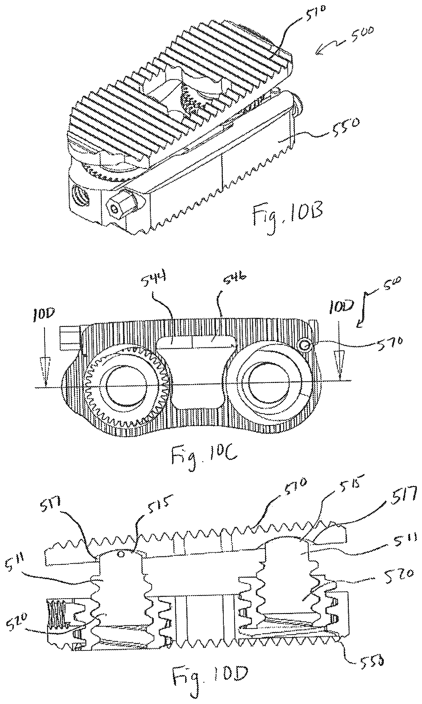Patent US12496197 Figure 14 – Medical device employing a coaxial screw gear sleeve mechanism