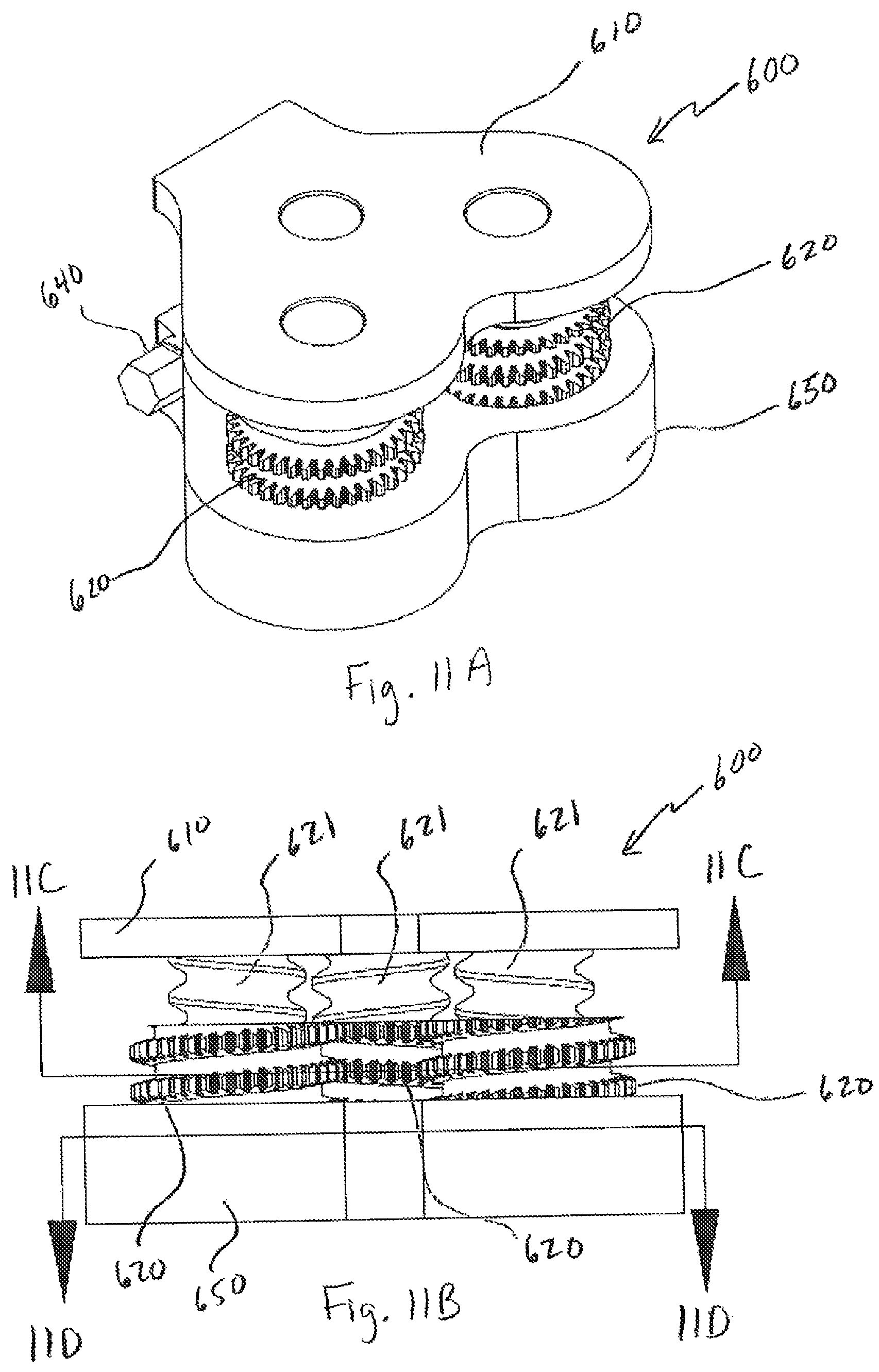 Patent US12496197 Figure 15 – Medical device employing a coaxial screw gear sleeve mechanism