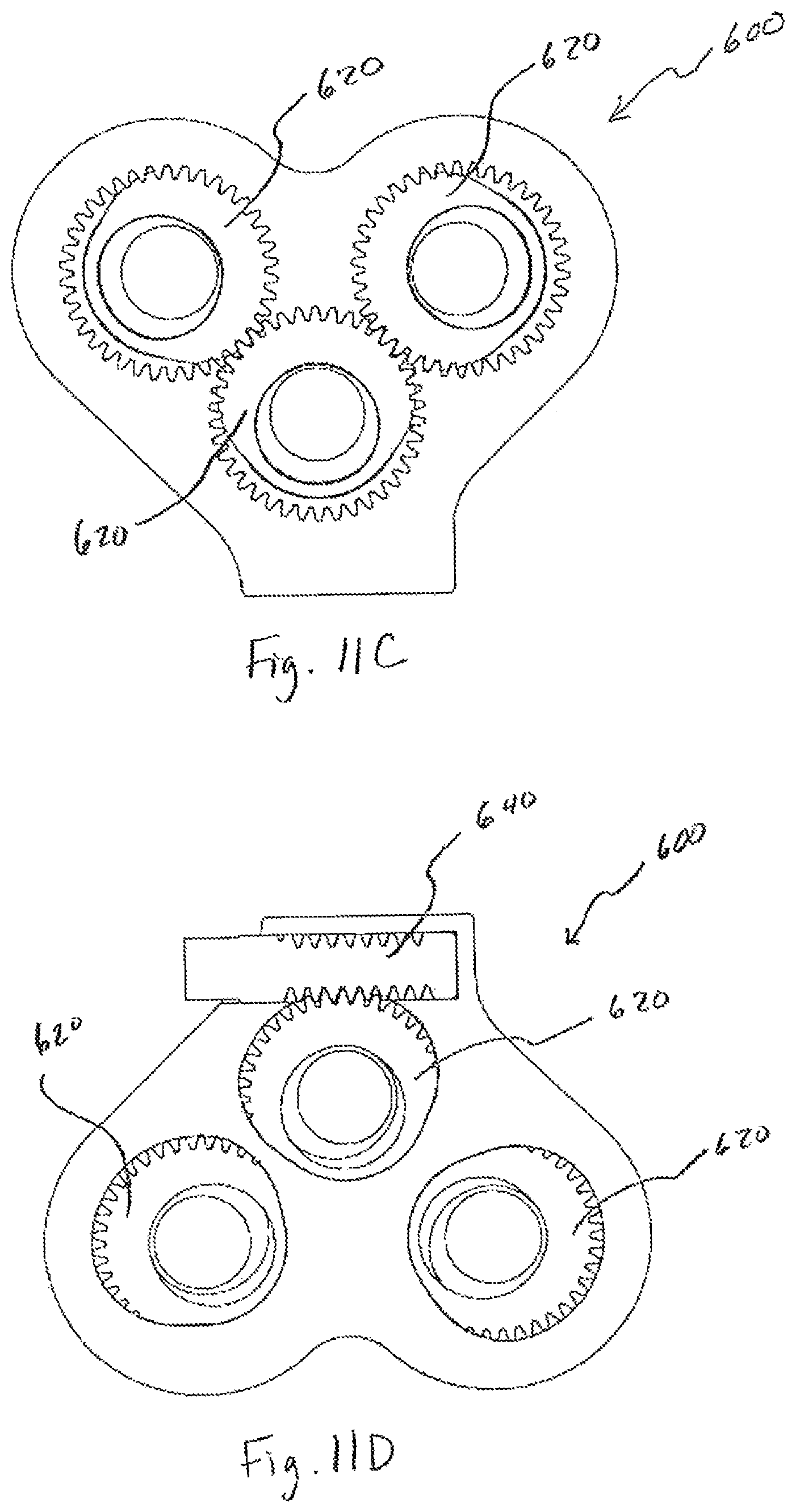 Patent US12496197 Figure 16 – Medical device employing a coaxial screw gear sleeve mechanism