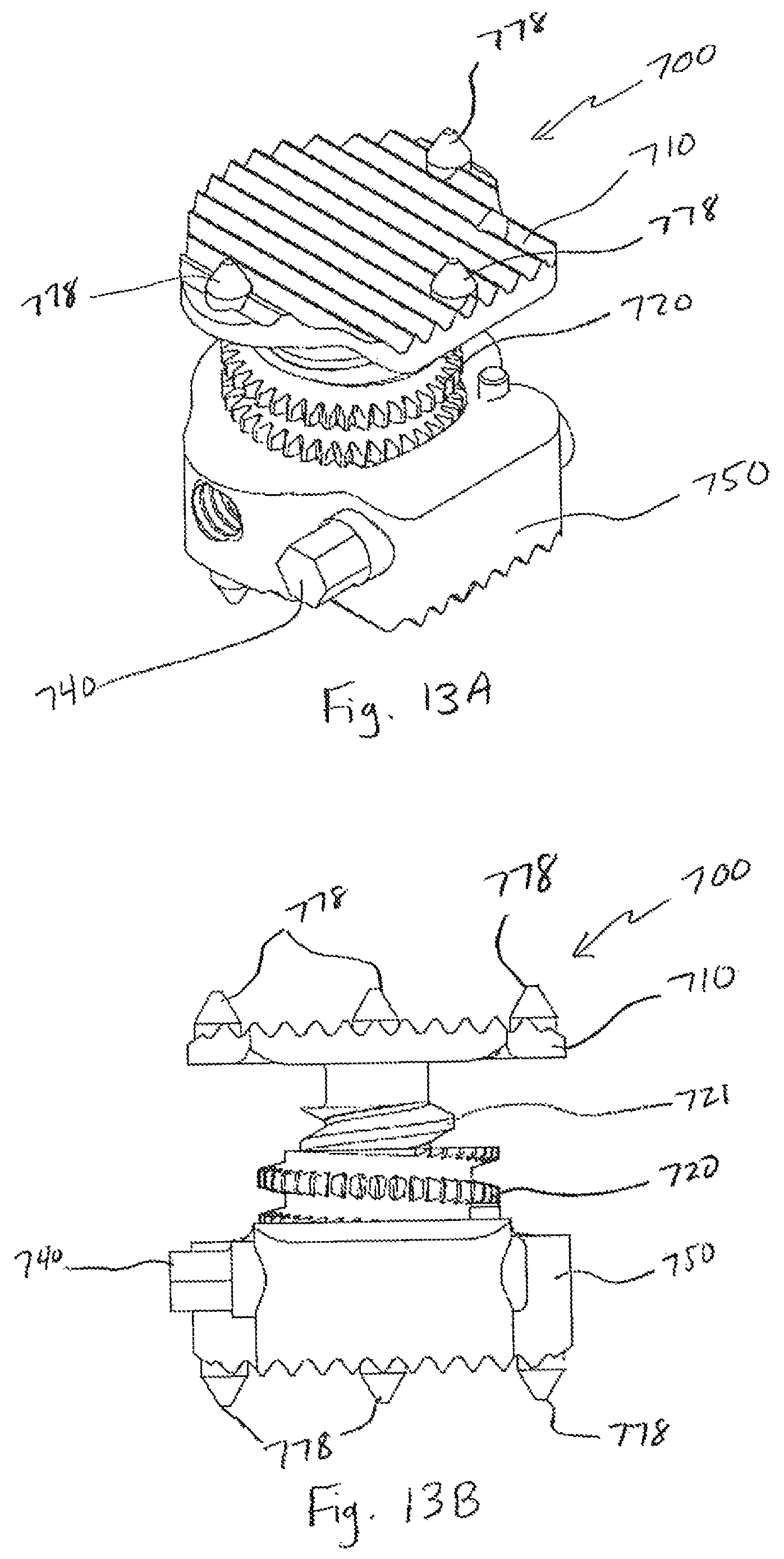 Patent US12496197 Figure 18 – Medical device employing a coaxial screw gear sleeve mechanism
