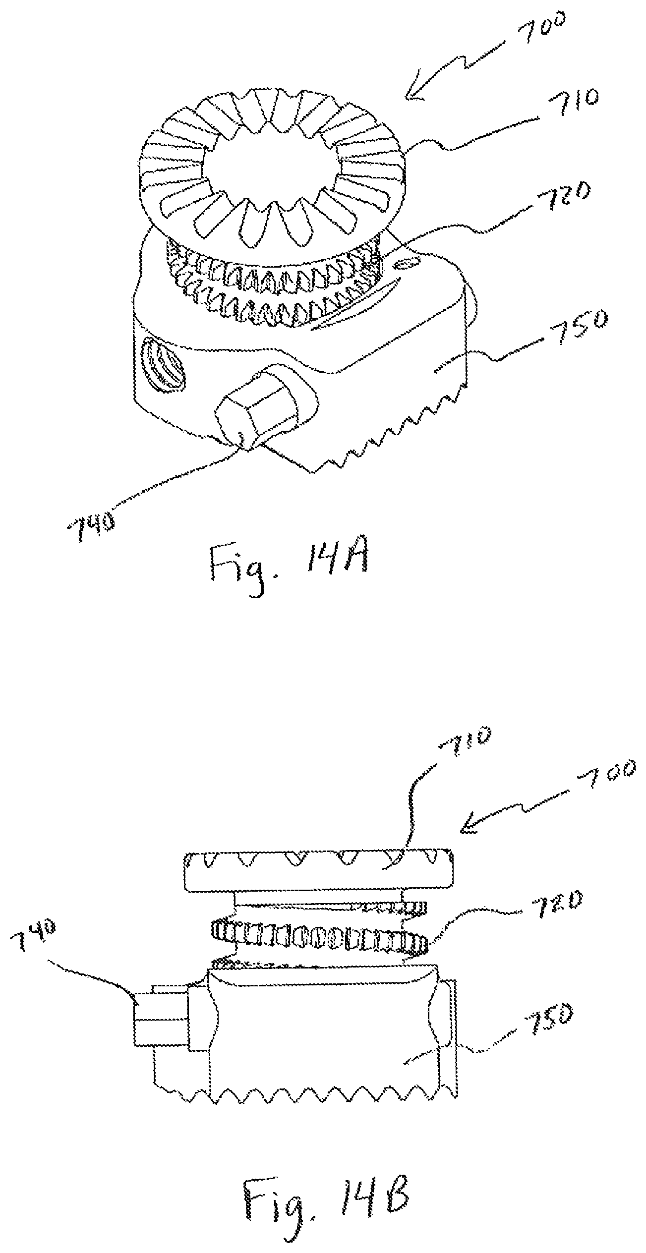 Patent US12496197 Figure 19 – Medical device employing a coaxial screw gear sleeve mechanism