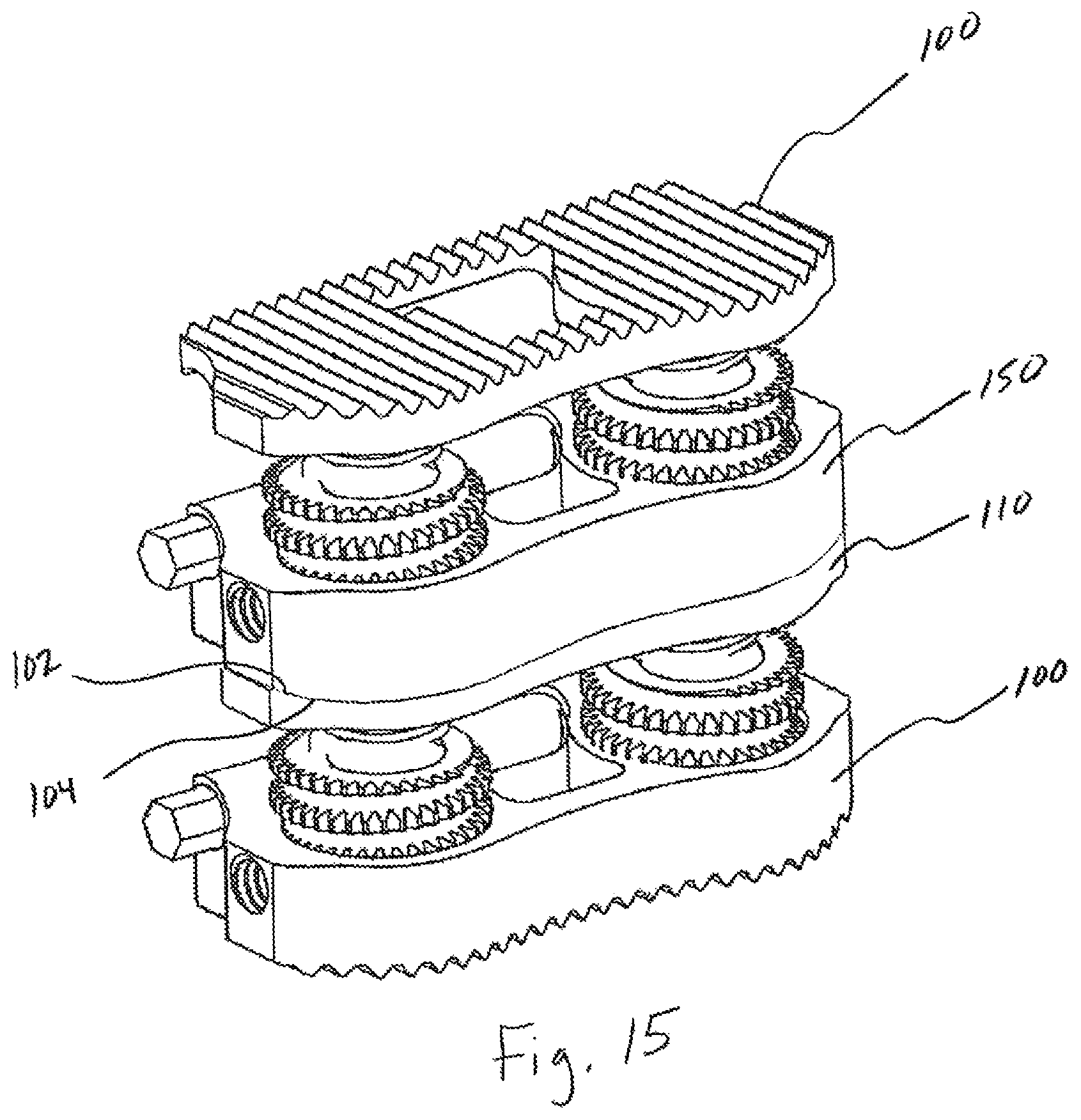 Patent US12496197 Figure 20 – Medical device employing a coaxial screw gear sleeve mechanism