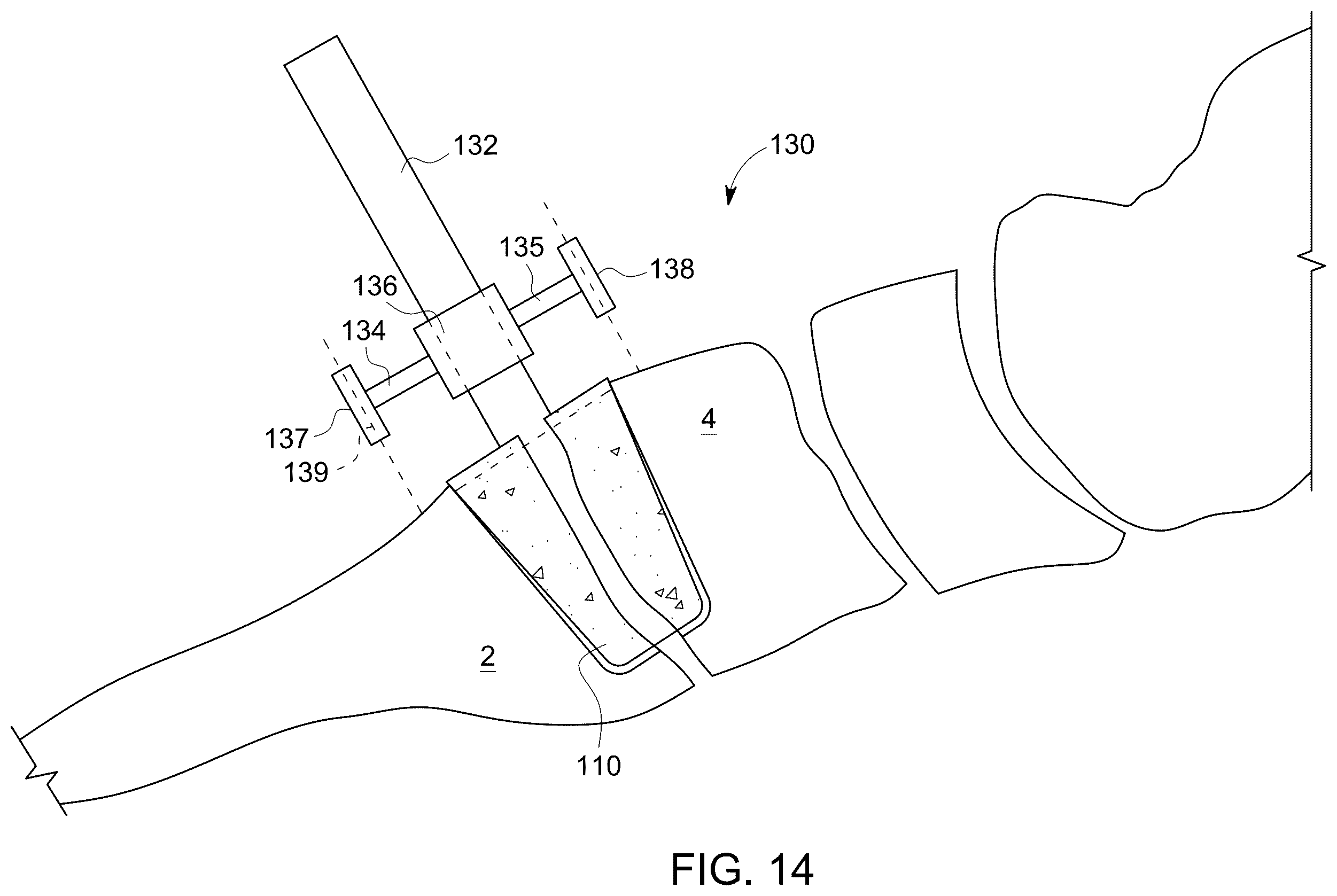 Patent US12496198 Figure 8 – Dowel guide instrument and method for treating mid-foot disorders