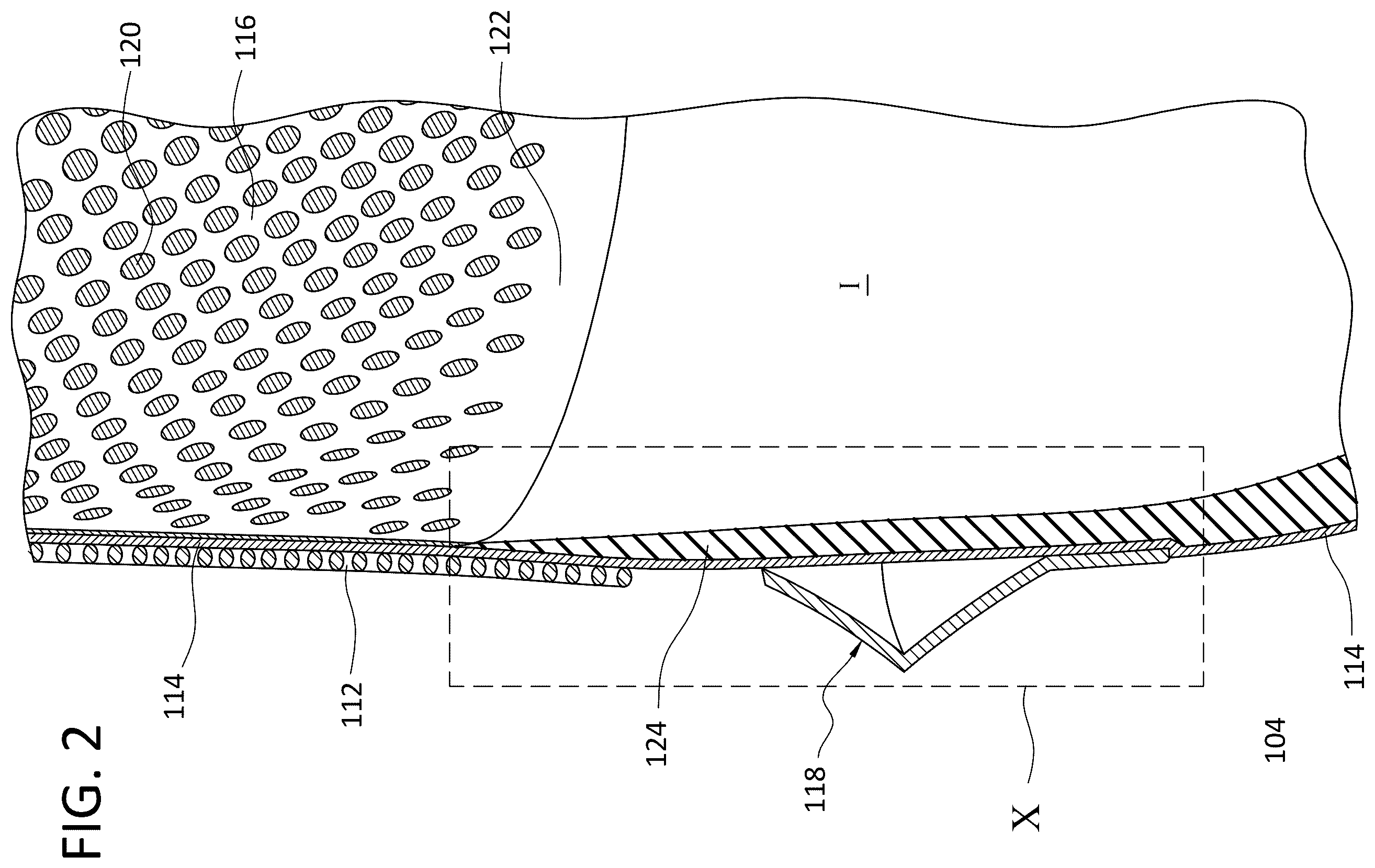 Patent US12496199 Figure 2 – Ventilated prosthetic liner