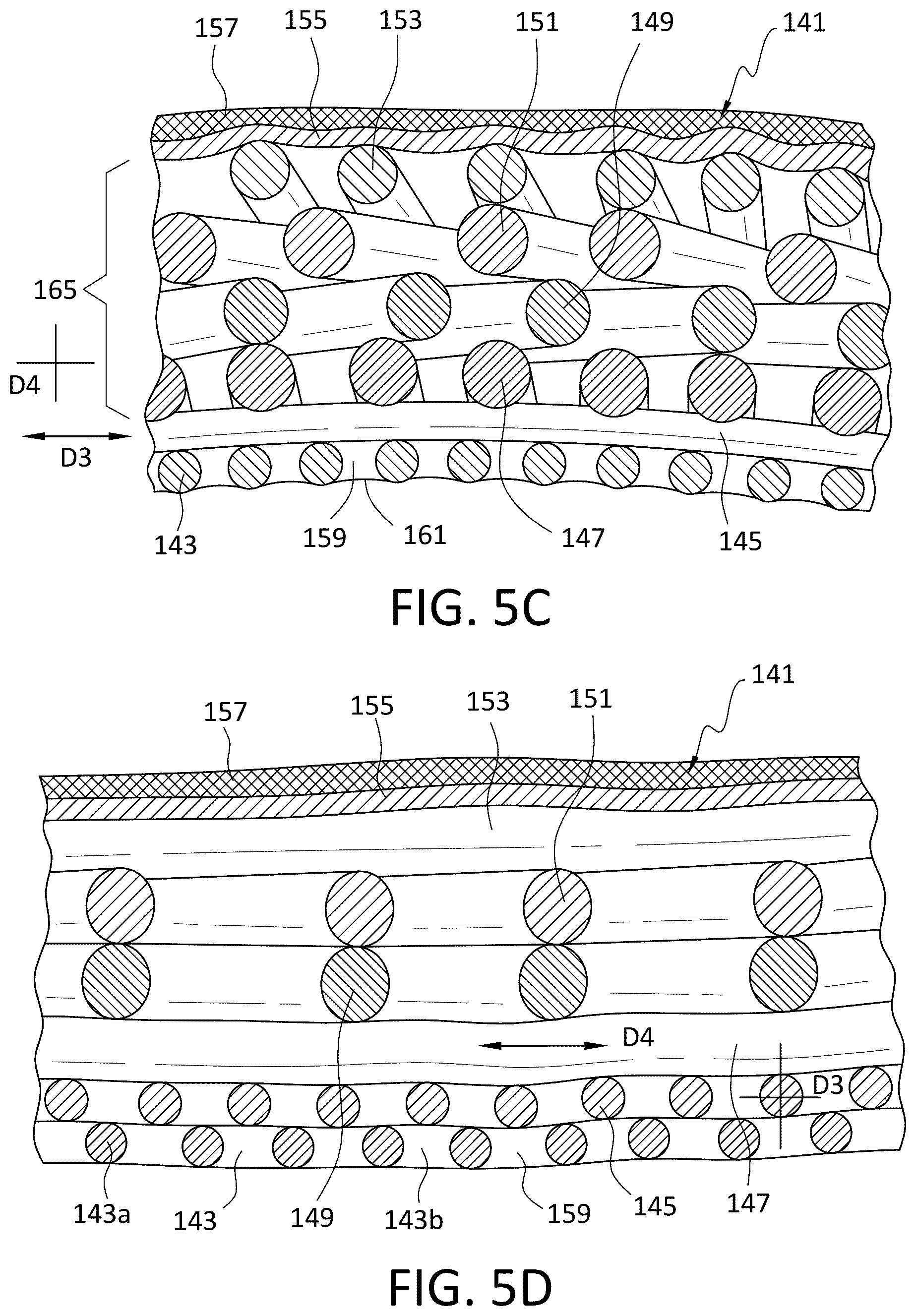 Patent US12496199 Figure 5 – Ventilated prosthetic liner