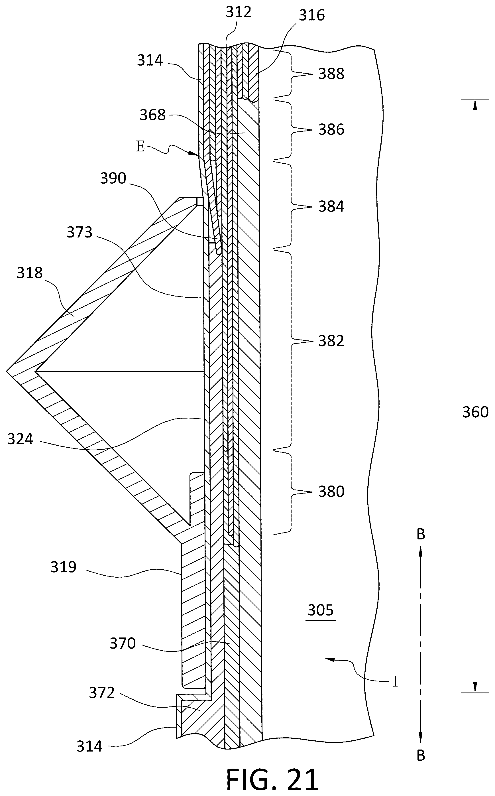 Patent US12496199 Figure 13 – Ventilated prosthetic liner
