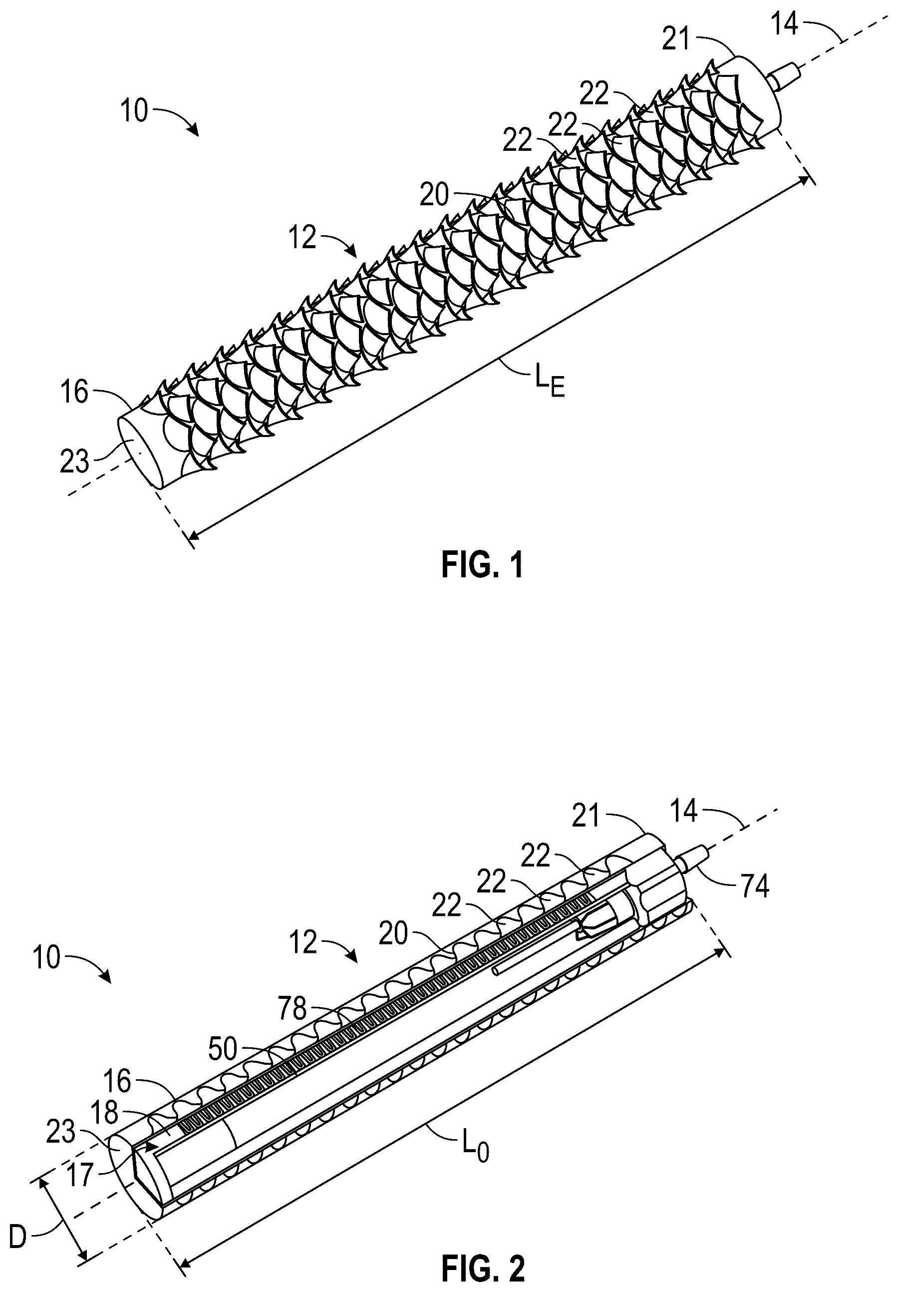 Patent US12496200 Figure 1 – Kirigami-inspired stents for sustained local delivery of therapeutics