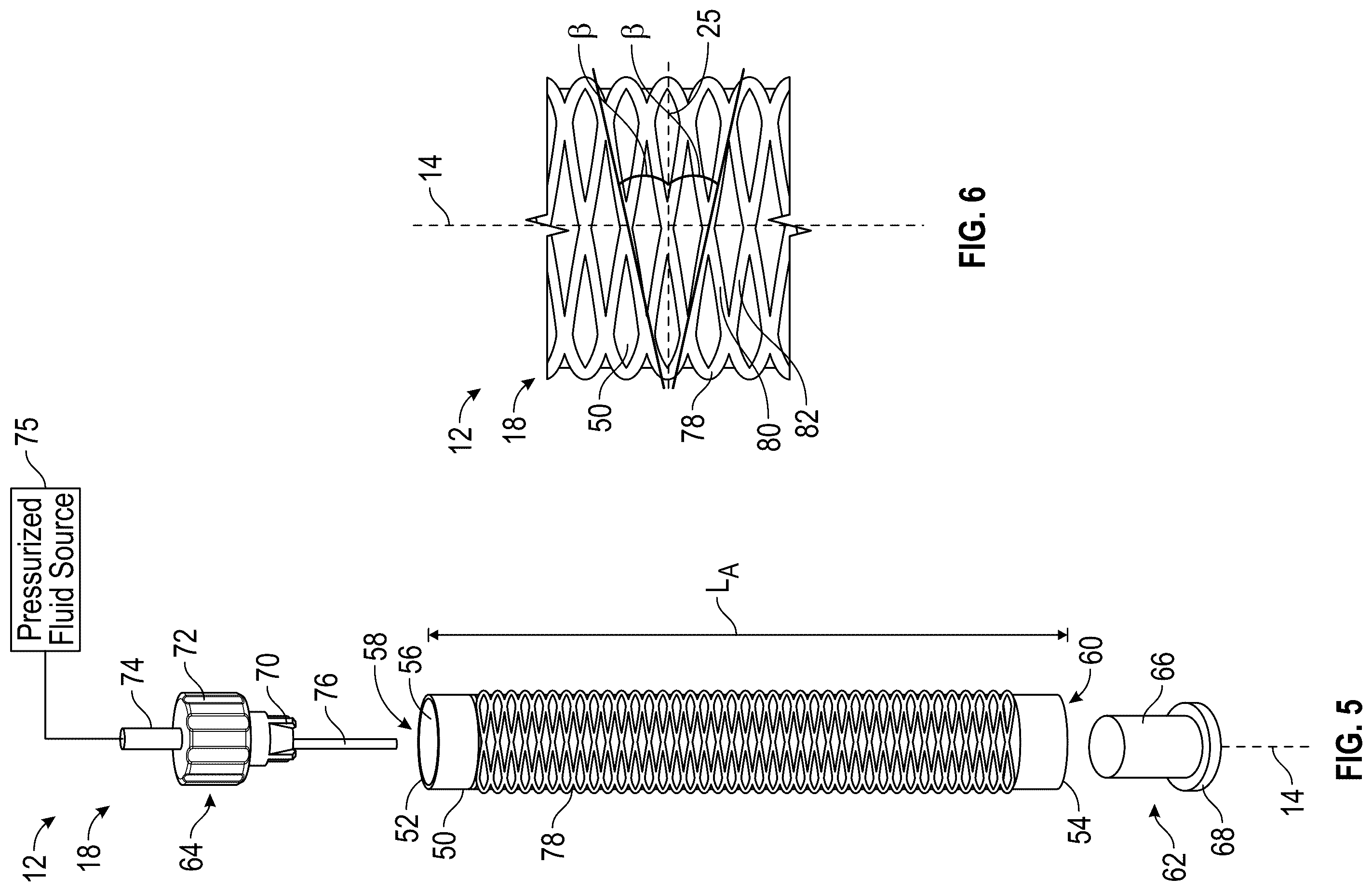 Patent US12496200 Figure 3 – Kirigami-inspired stents for sustained local delivery of therapeutics