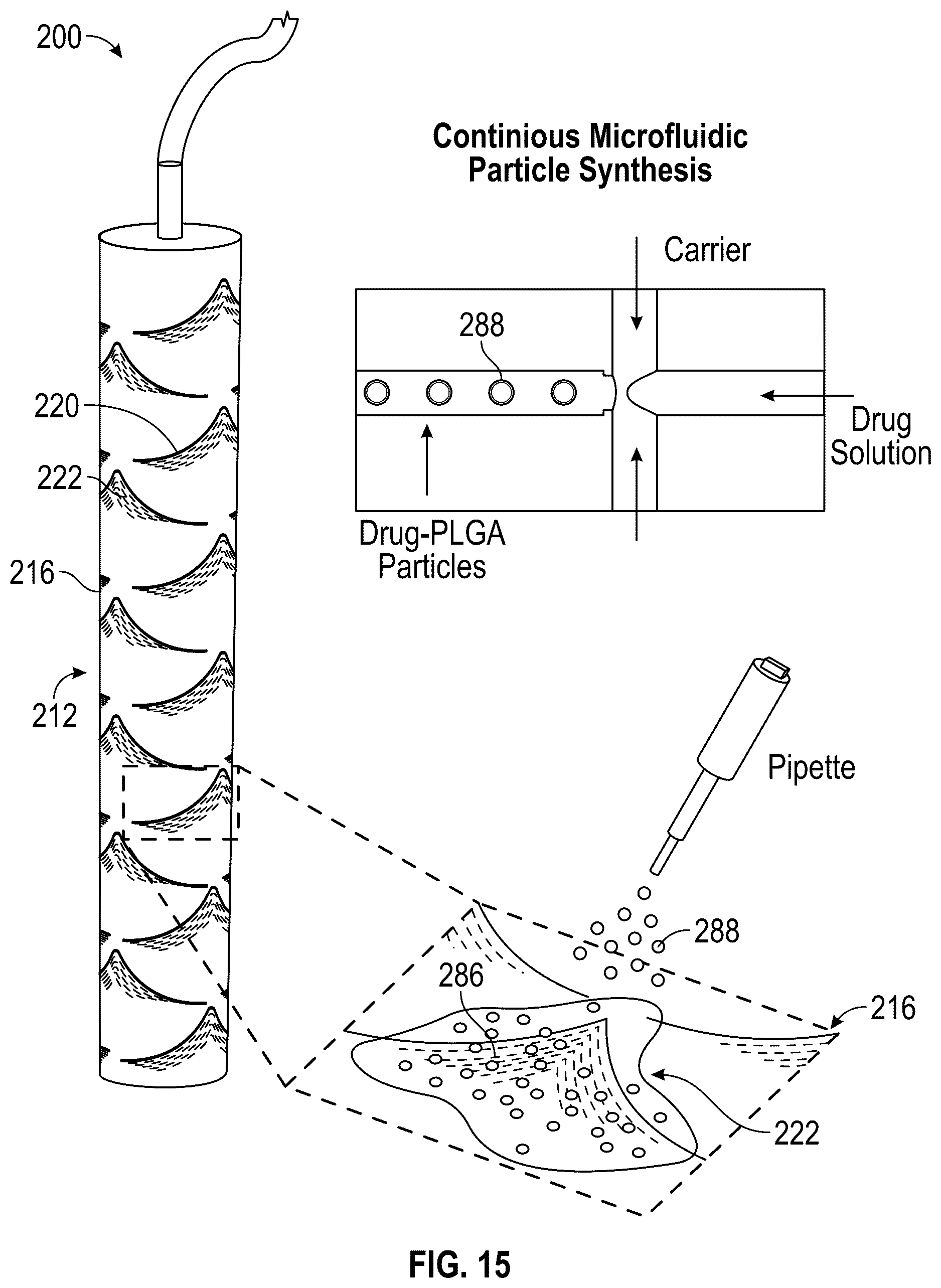 Patent US12496200 Figure 7 – Kirigami-inspired stents for sustained local delivery of therapeutics