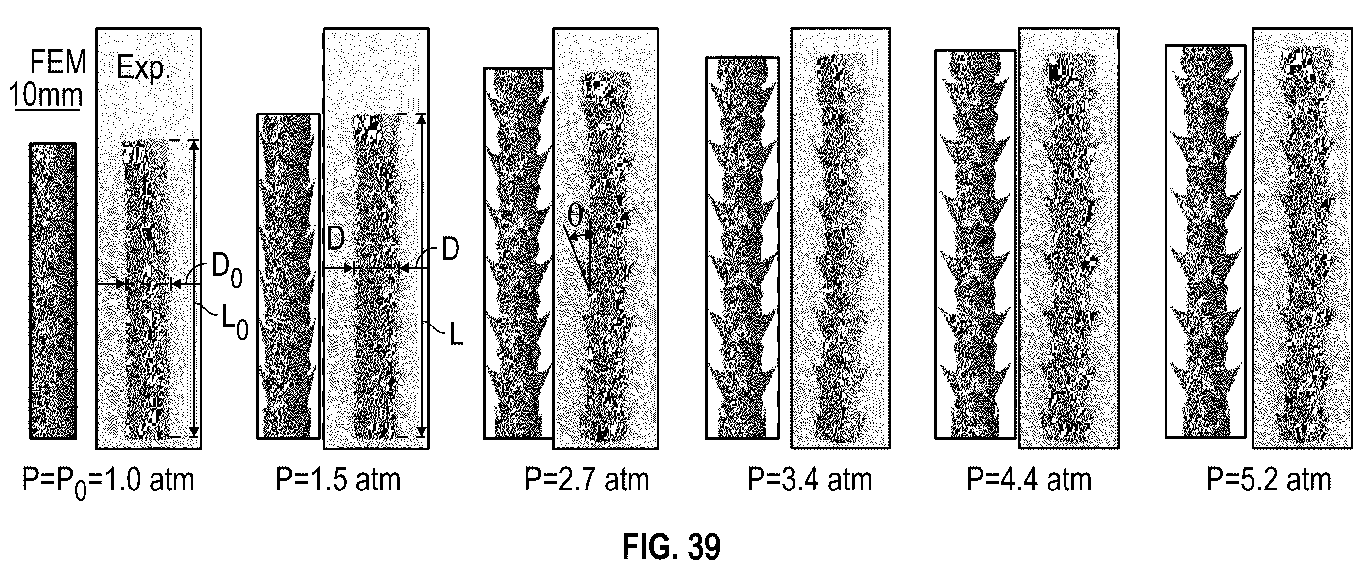 Patent US12496200 Figure 19 – Kirigami-inspired stents for sustained local delivery of therapeutics