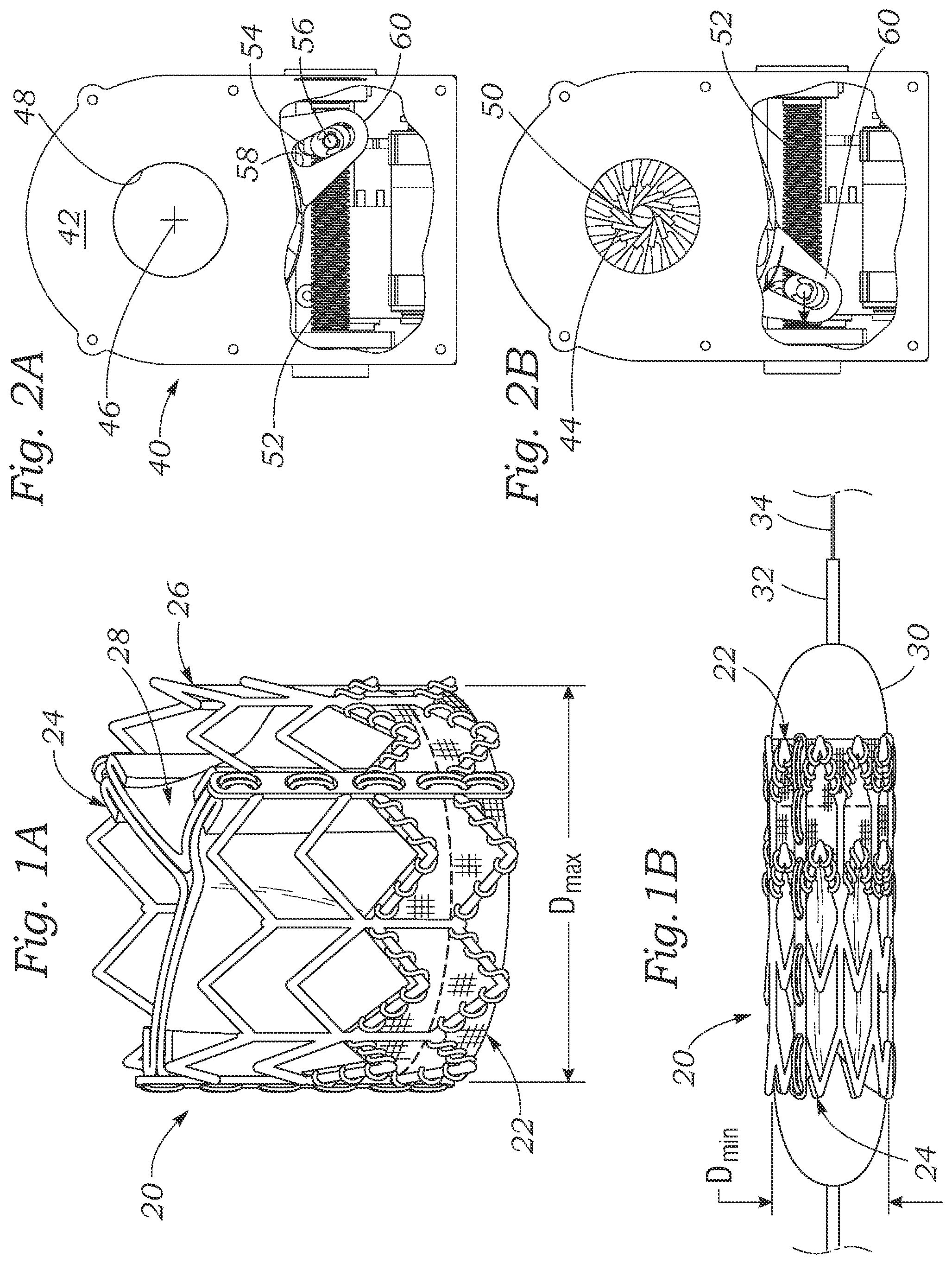 Patent US12496202 Figure 1 – Crimping device