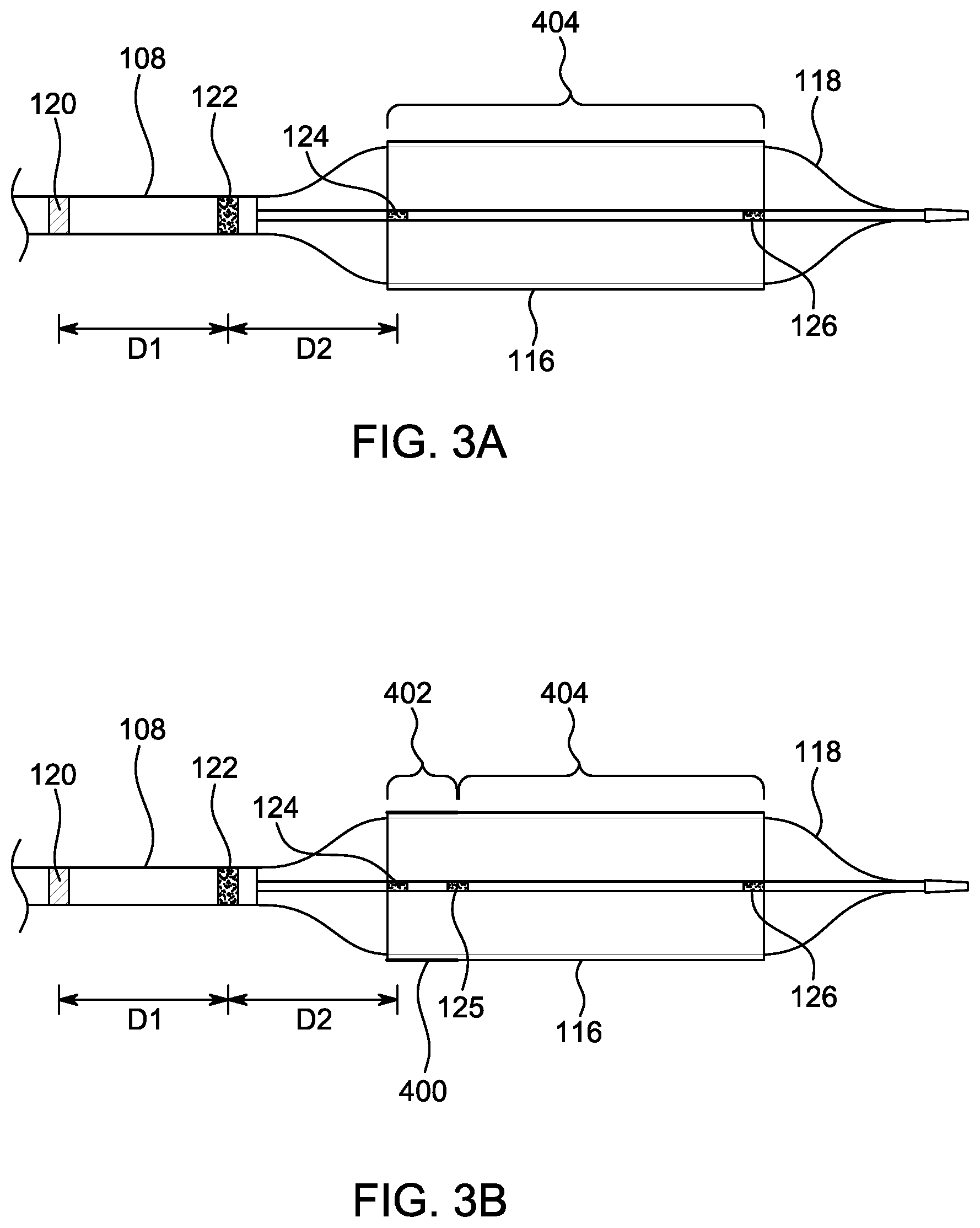 Patent US12496203 Figure 3 – Ostial stenting under vision