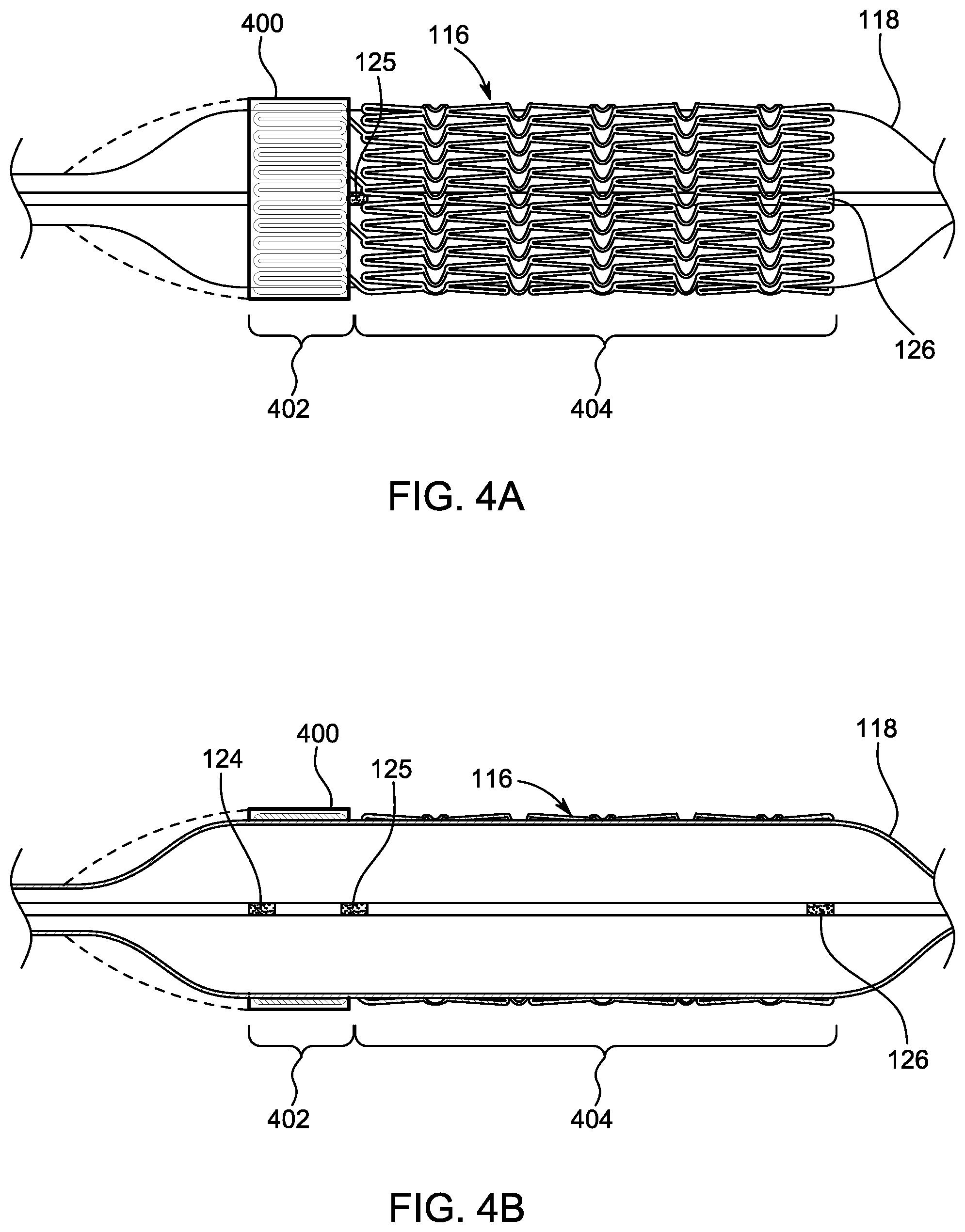 Patent US12496203 Figure 4 – Ostial stenting under vision