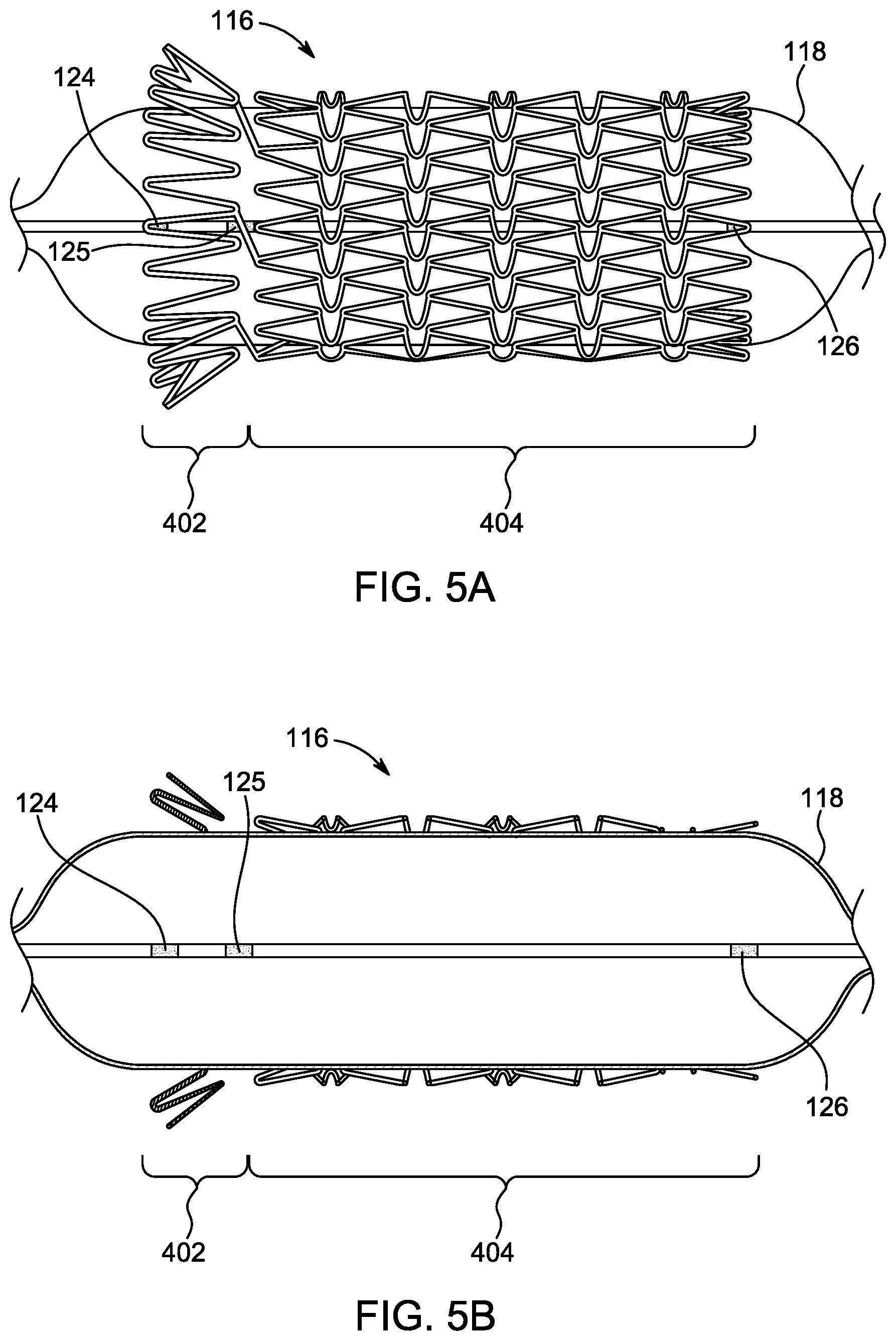 Patent US12496203 Figure 5 – Ostial stenting under vision