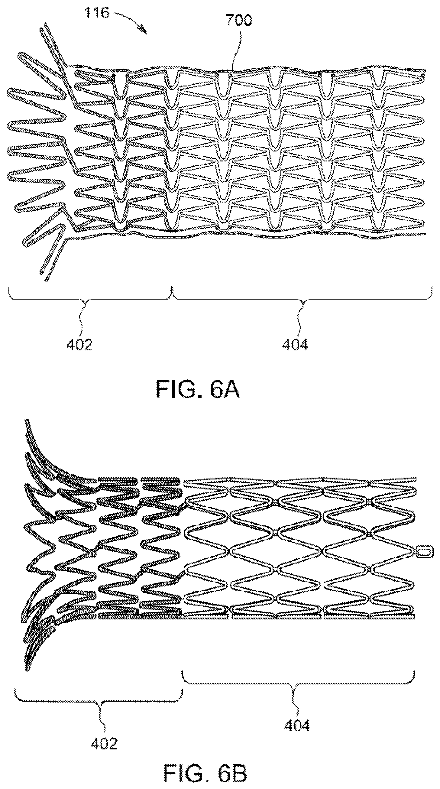 Patent US12496203 Figure 7 – Ostial stenting under vision