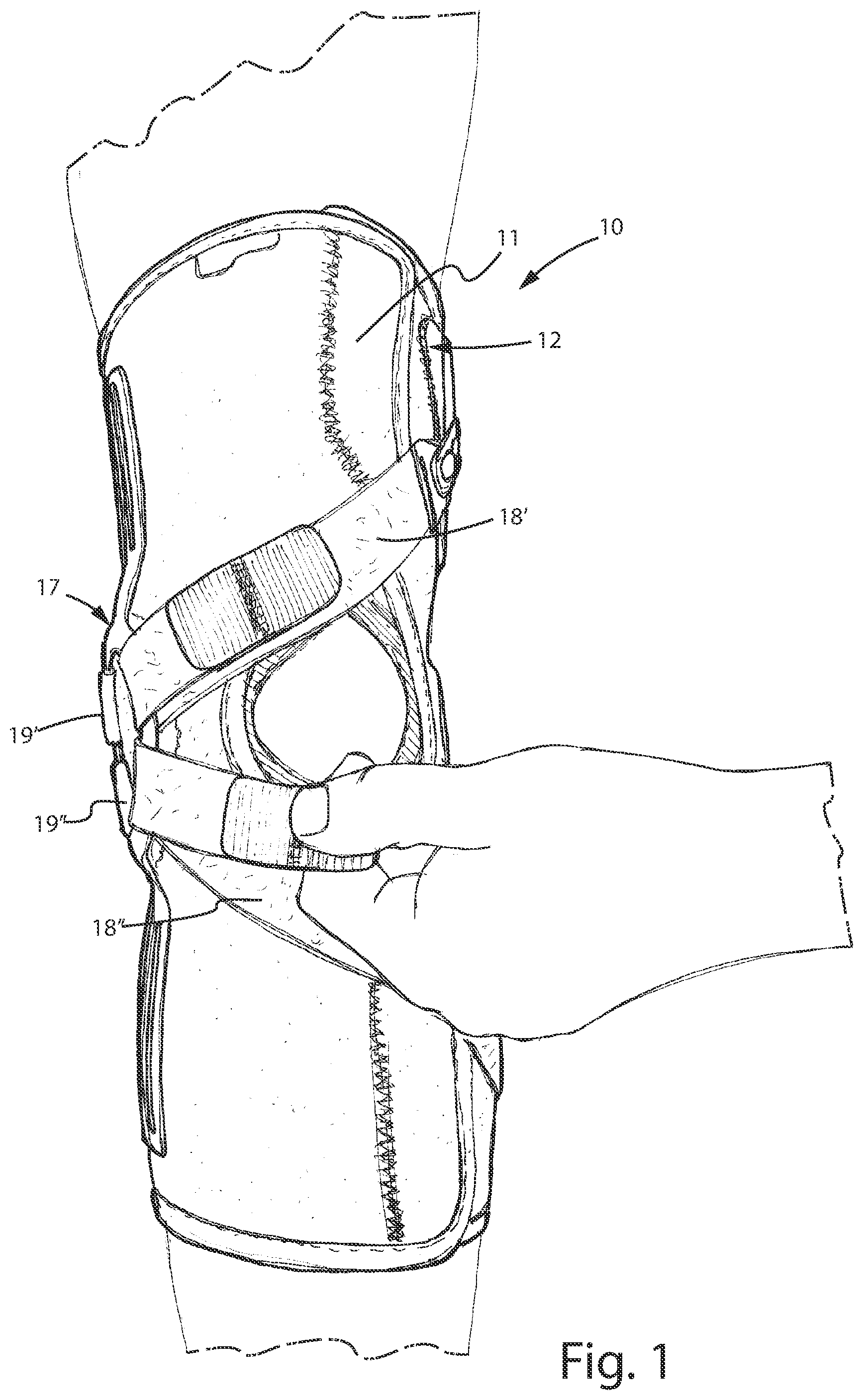 Patent US12496205 Figure 1 – Knee brace for the treatment of gonarthrosis