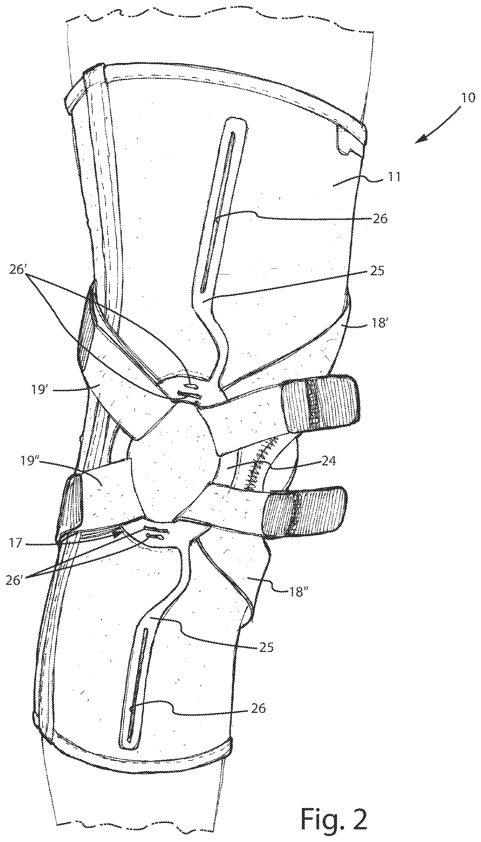 Patent US12496205 Figure 2 – Knee brace for the treatment of gonarthrosis