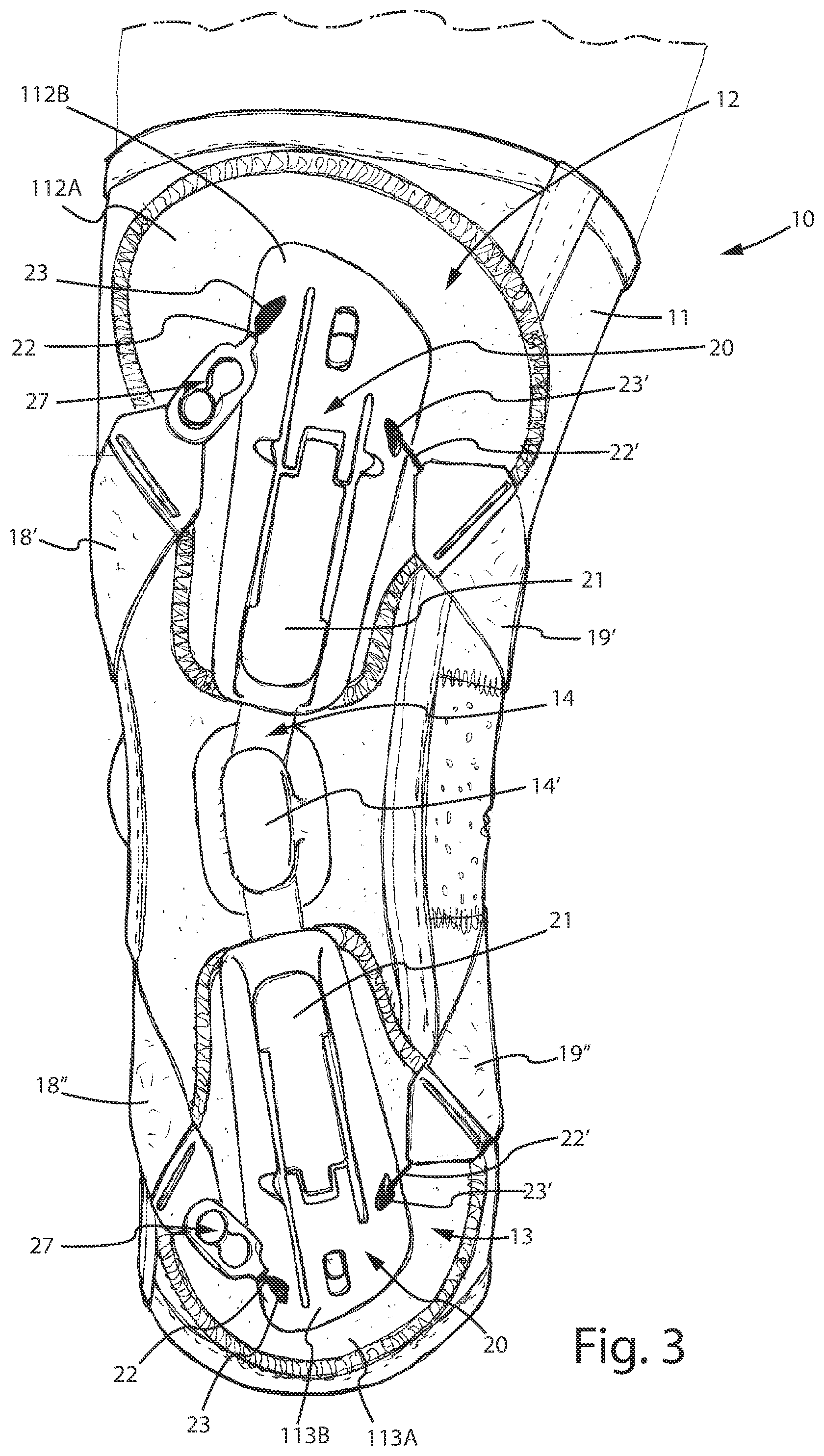 Patent US12496205 Figure 3 – Knee brace for the treatment of gonarthrosis