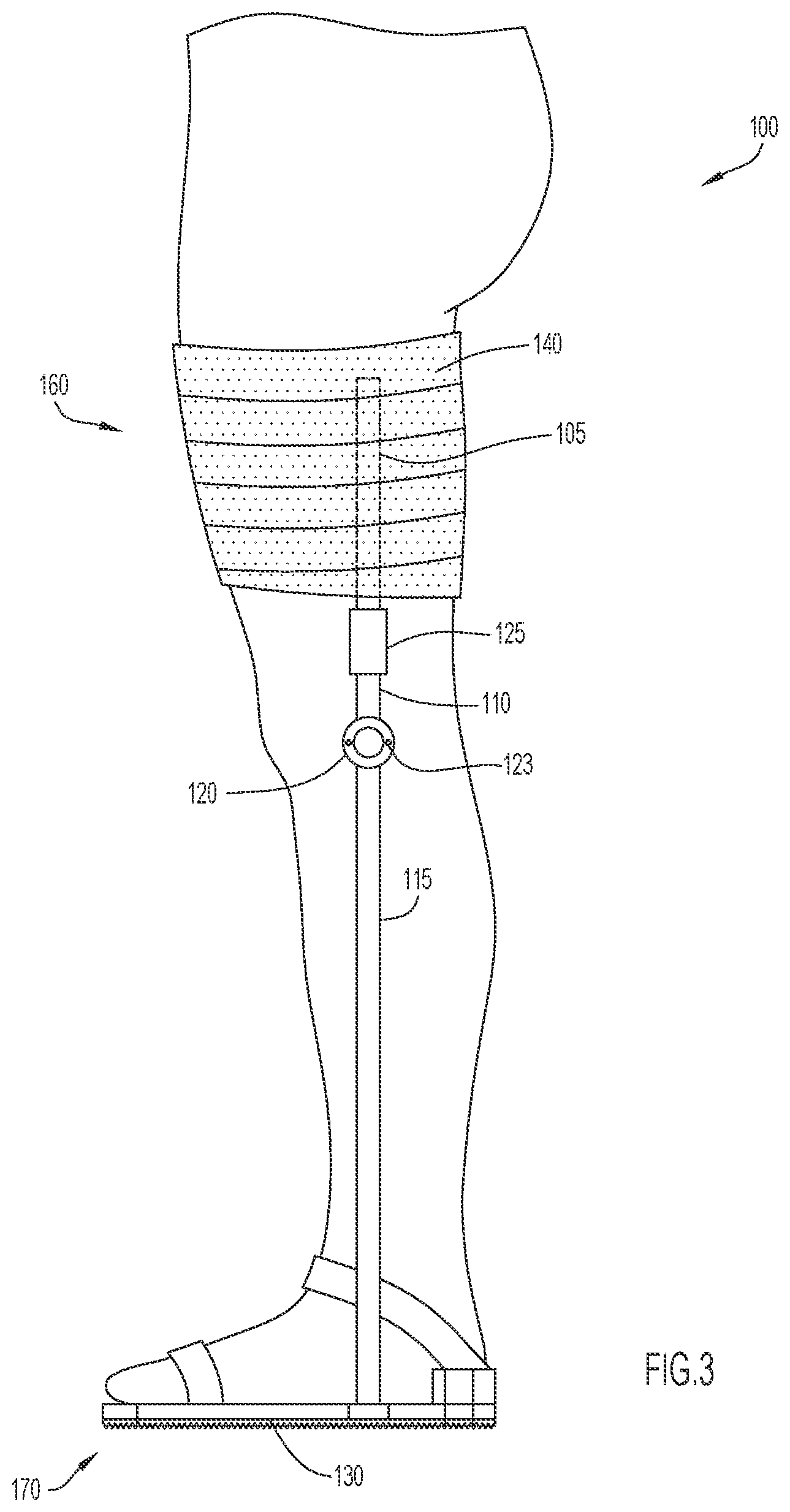 Patent US12496210 Figure 3 – Method and apparatus to maintain distance between bones of a neck for pain relief