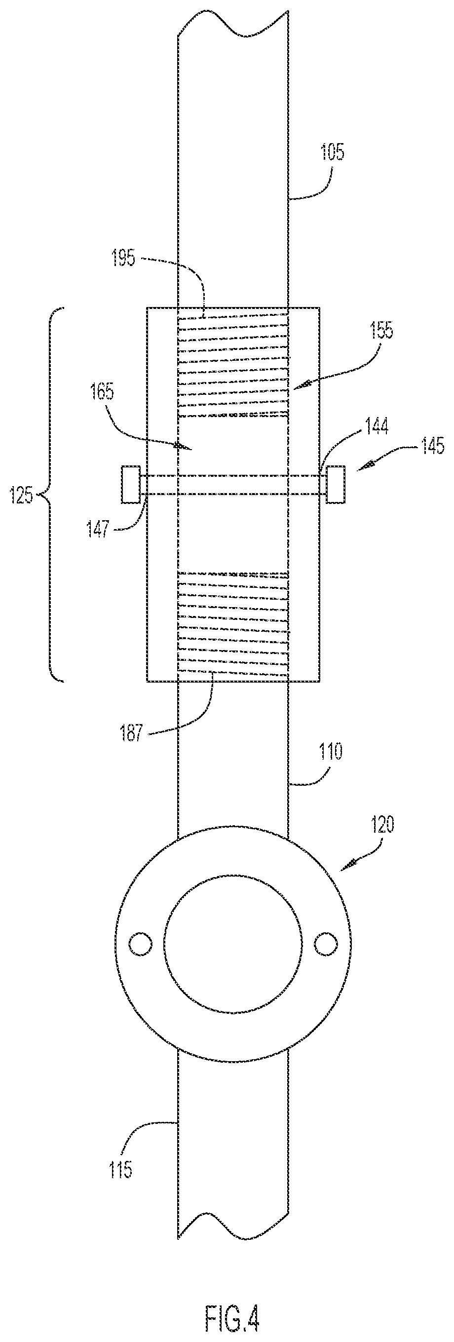 Patent US12496210 Figure 4 – Method and apparatus to maintain distance between bones of a neck for pain relief
