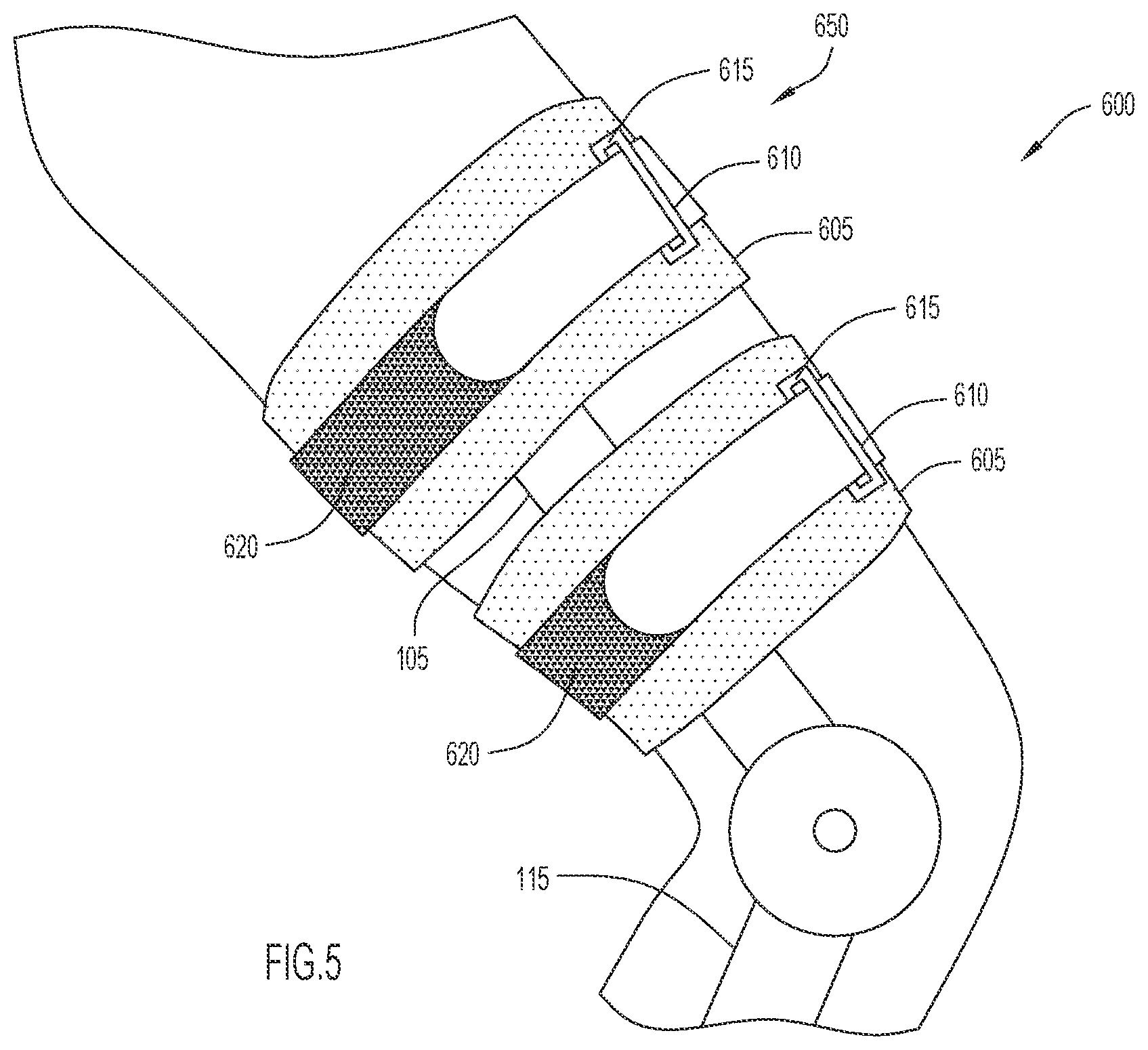 Patent US12496210 Figure 5 – Method and apparatus to maintain distance between bones of a neck for pain relief