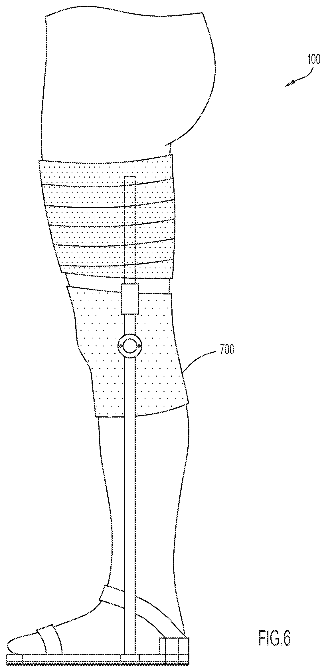 Patent US12496210 Figure 6 – Method and apparatus to maintain distance between bones of a neck for pain relief